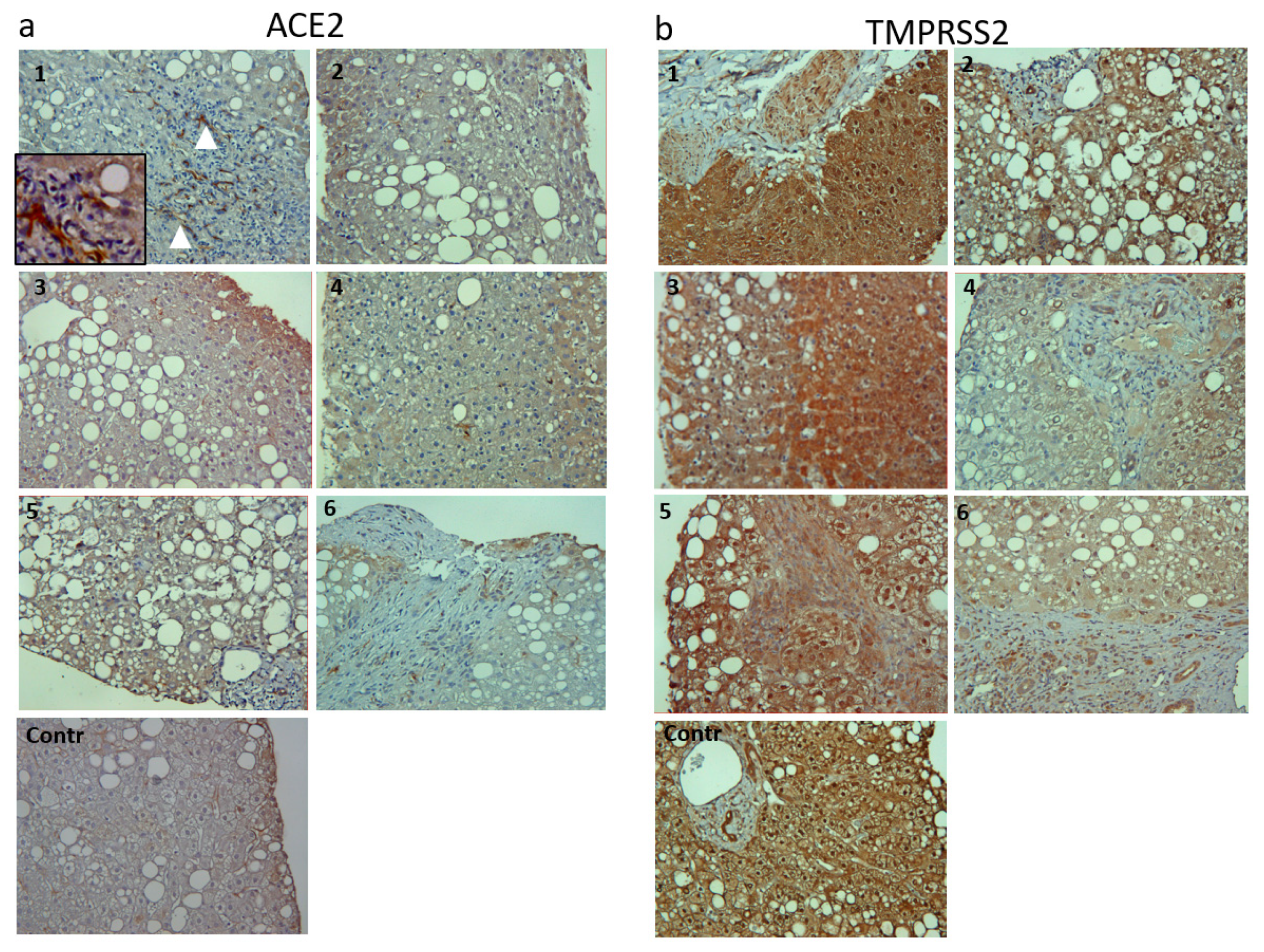 Viruses 14 02397 g004