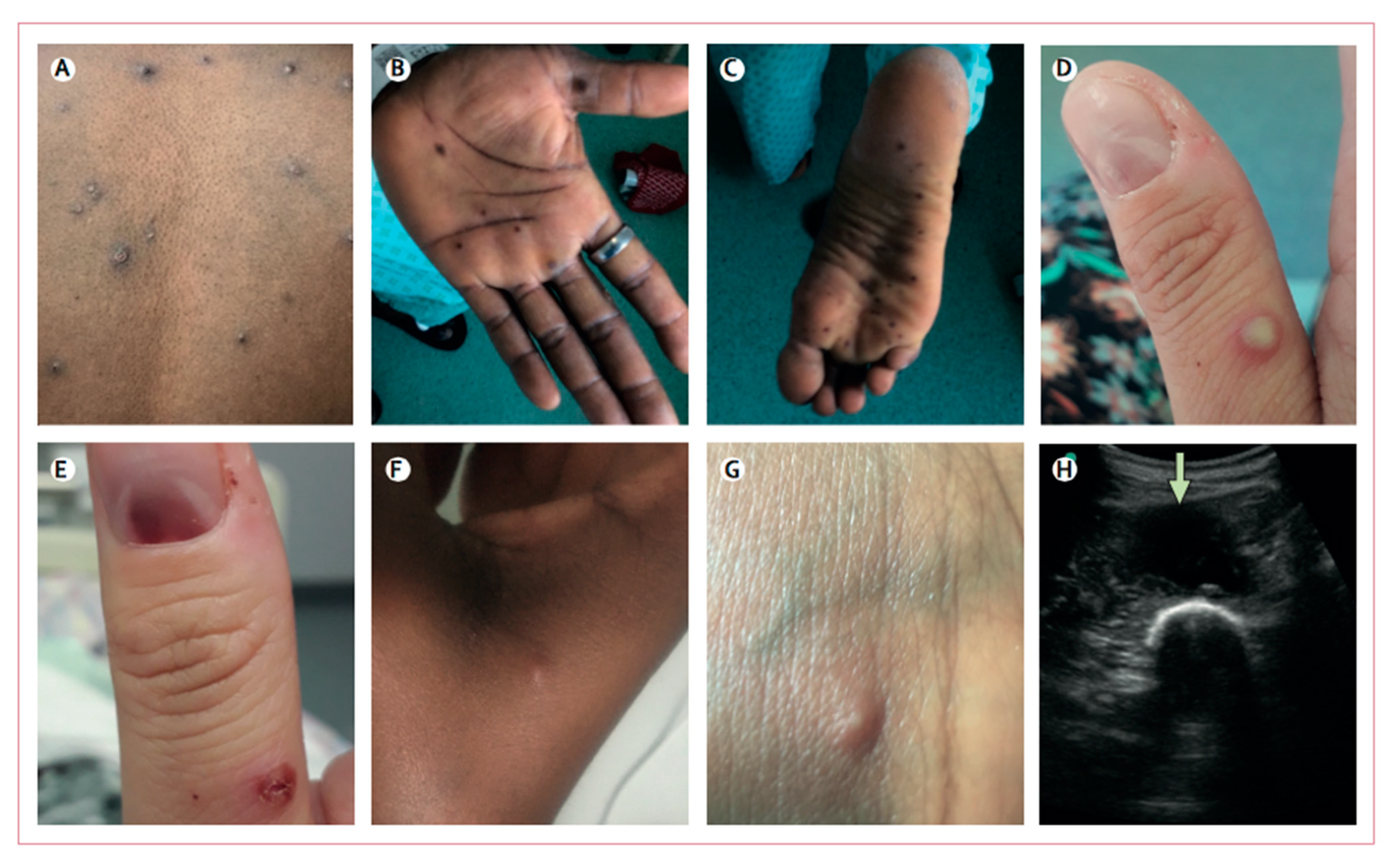 Viruses 14 02520 g002