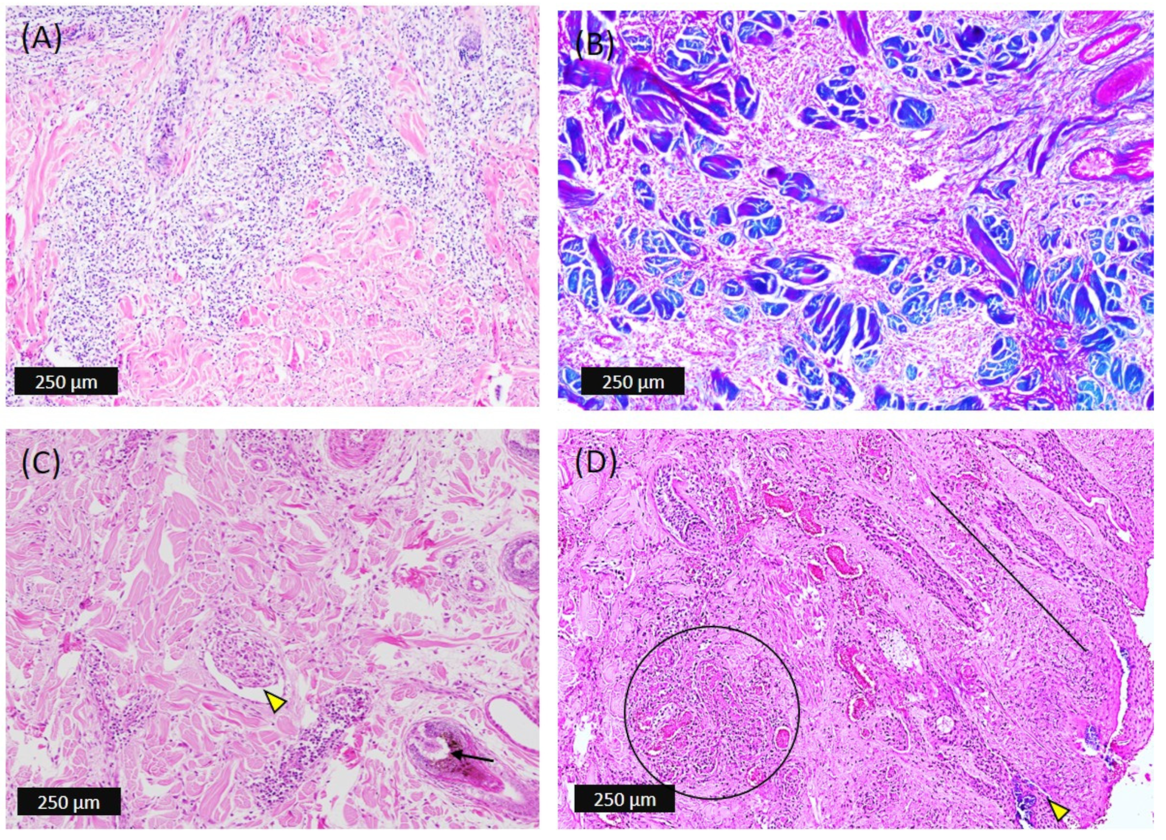 Viruses 14 02529 g004 Viruses 14 02529 g004