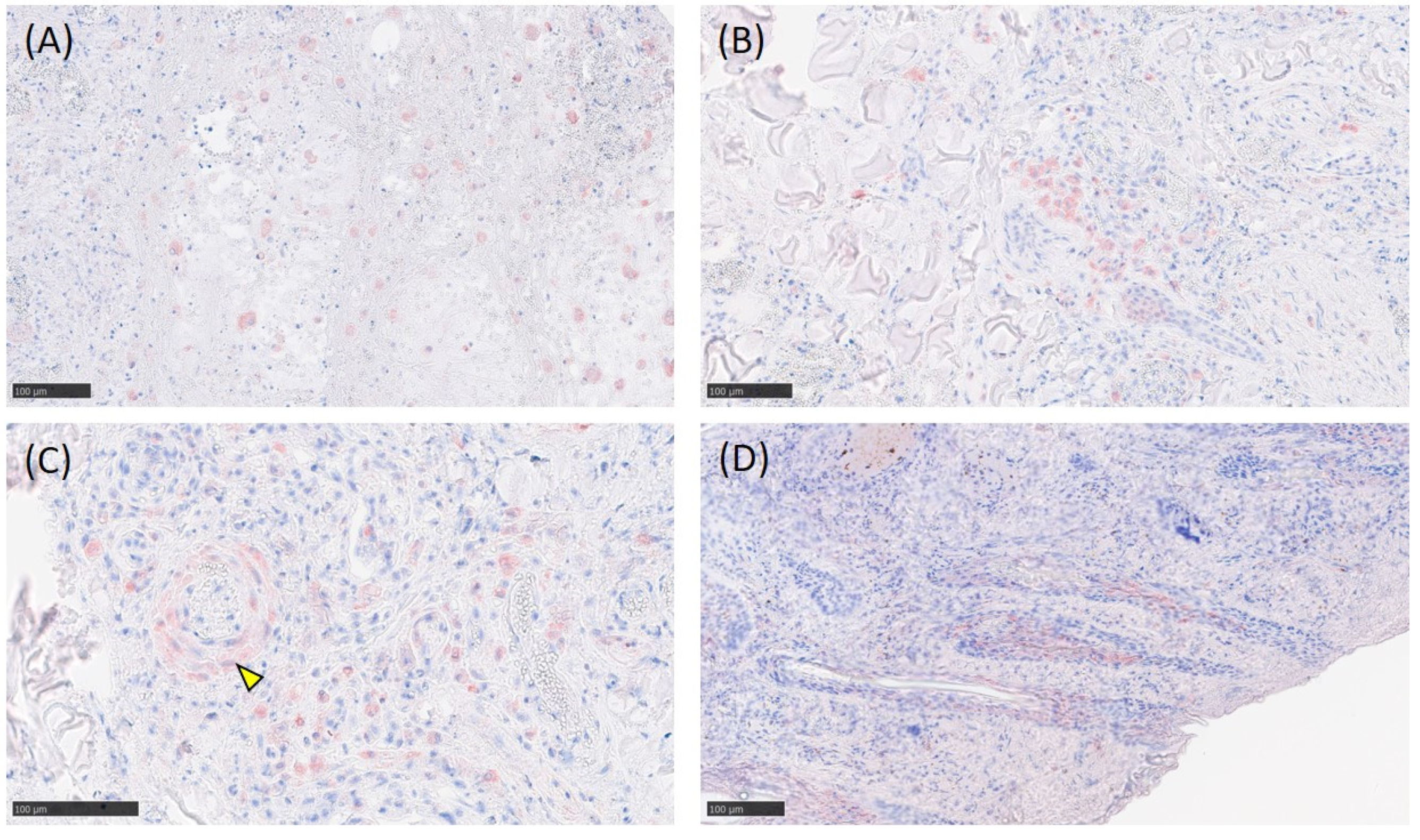 Viruses 14 02529 g005 Viruses 14 02529 g005