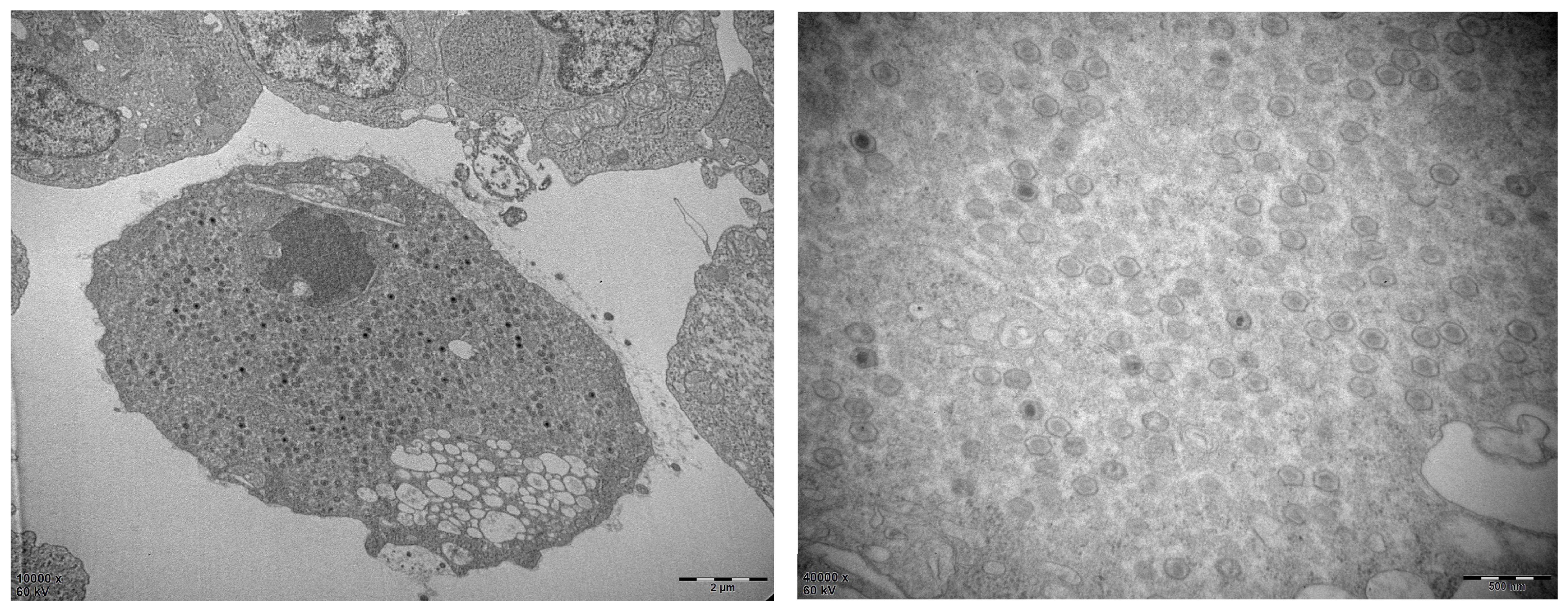 Viruses 15 00398 g001