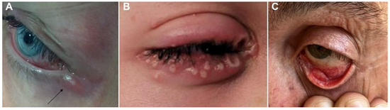 Viruses 15 00616 g001