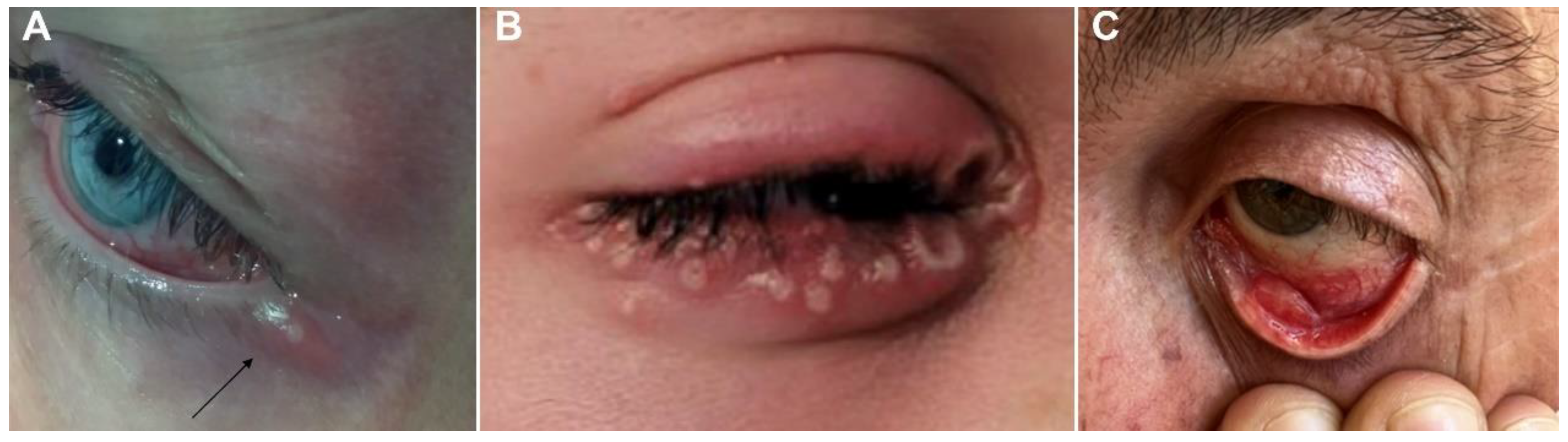 Viruses 15 00616 g001