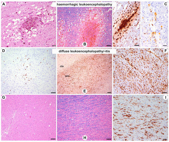 Viruses 15 00908 g002 550