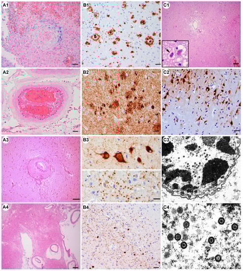 Viruses 15 00908 g003 550