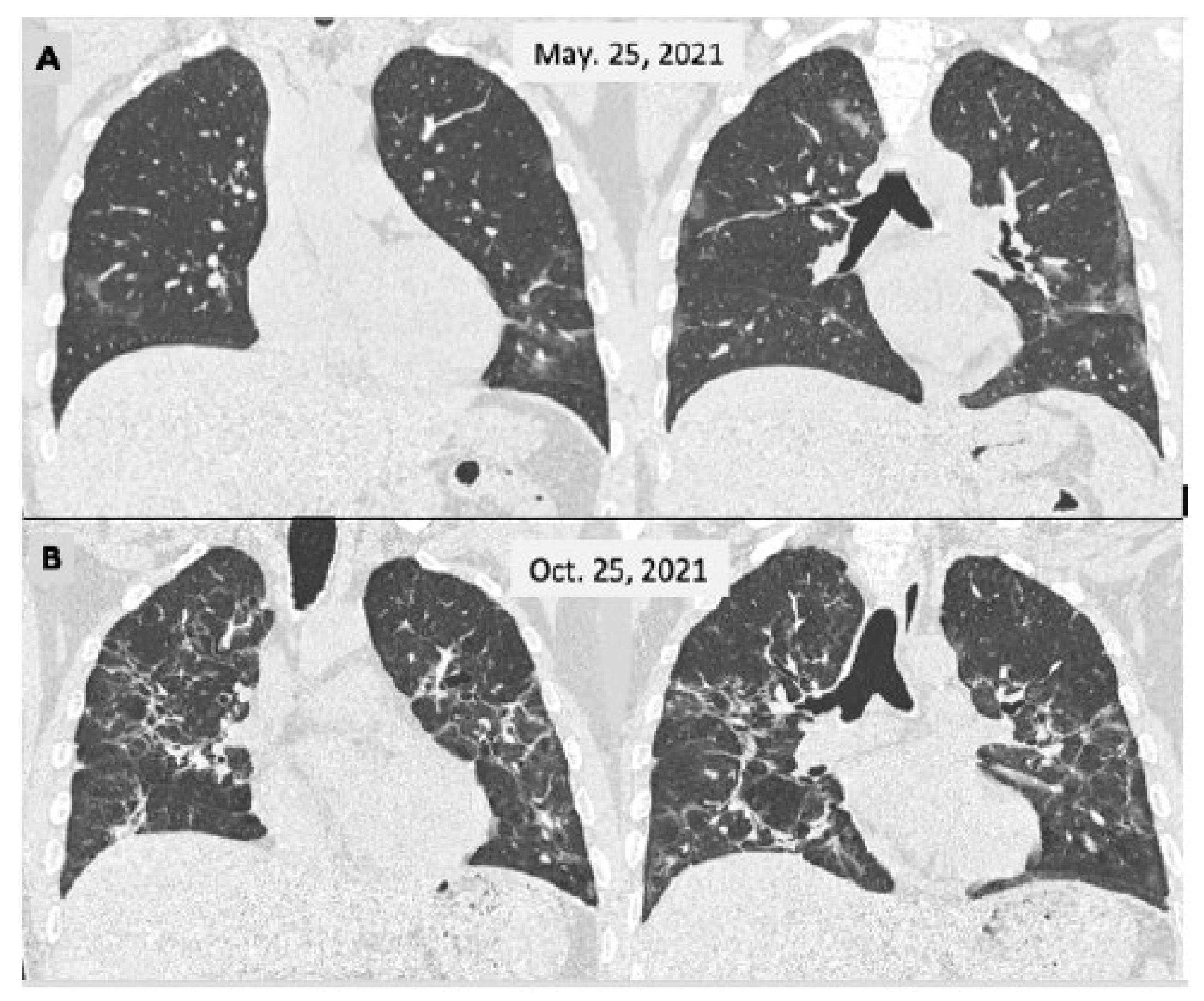 Viruses 15 01173 g002