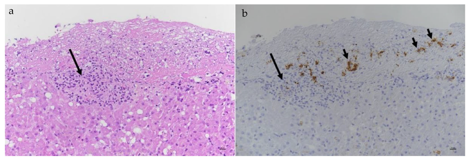 Viruses 15 01847 g023