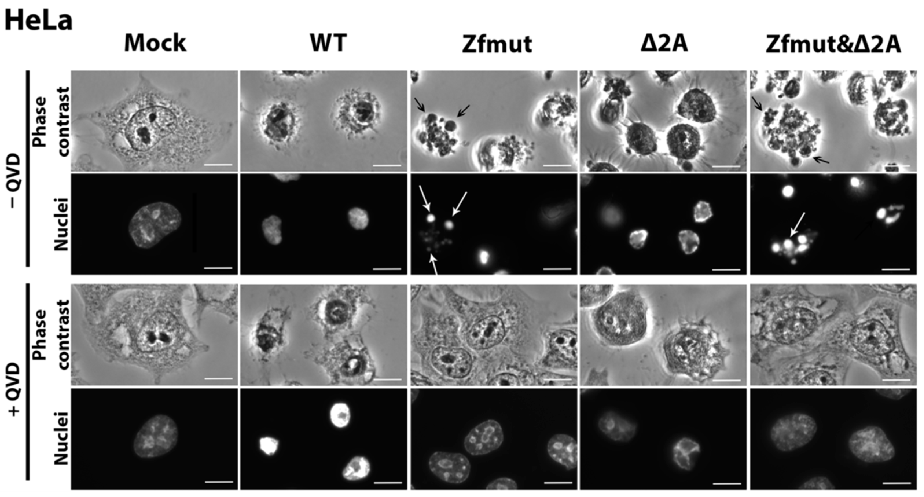 Viruses 16 00280 g004