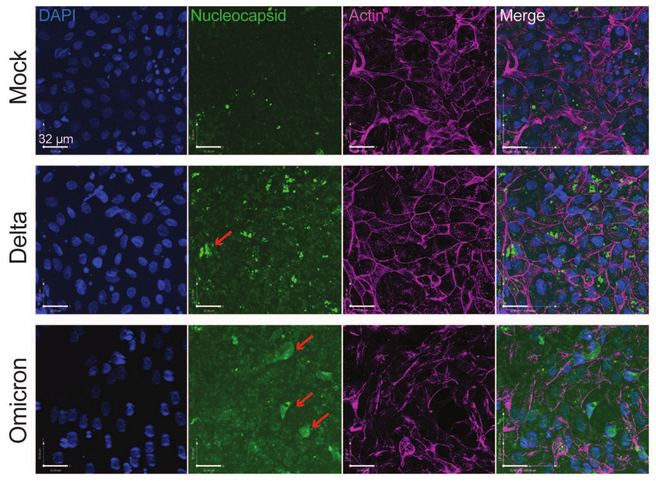 Viruses 16 00634 g002