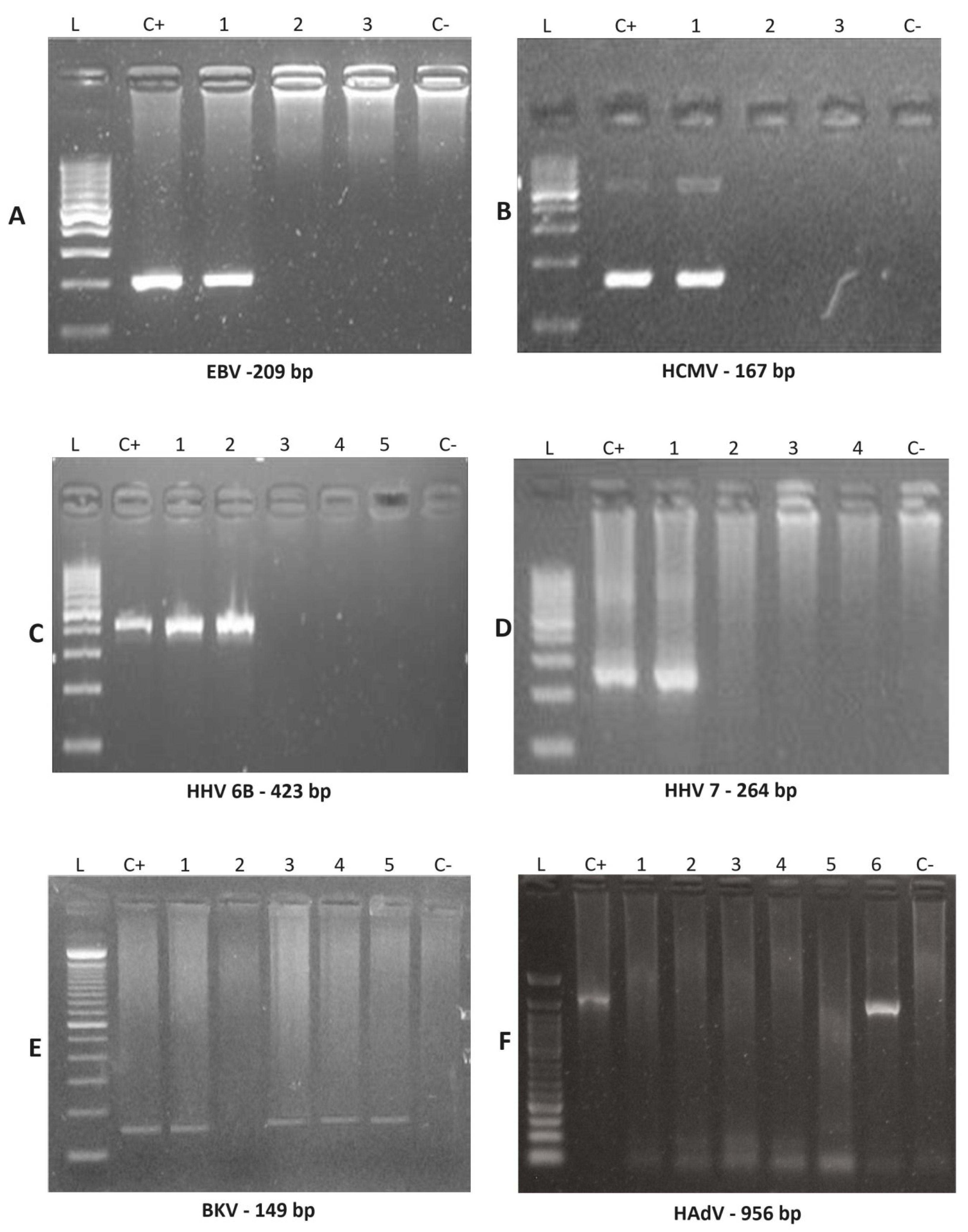 Viruses 16 01017 g001 Viruses 16 01017 g001