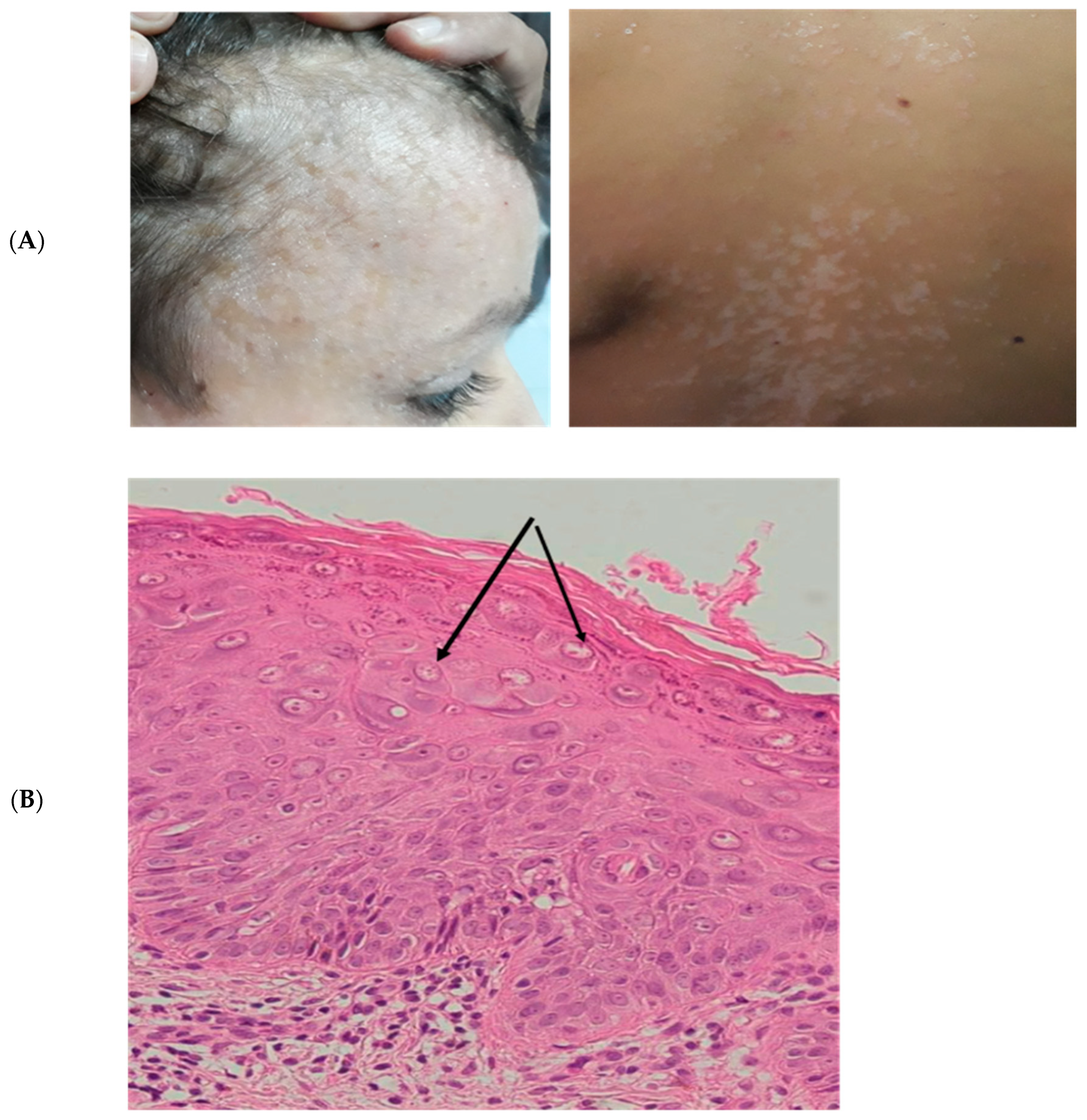 Viruses 16 01415 g001