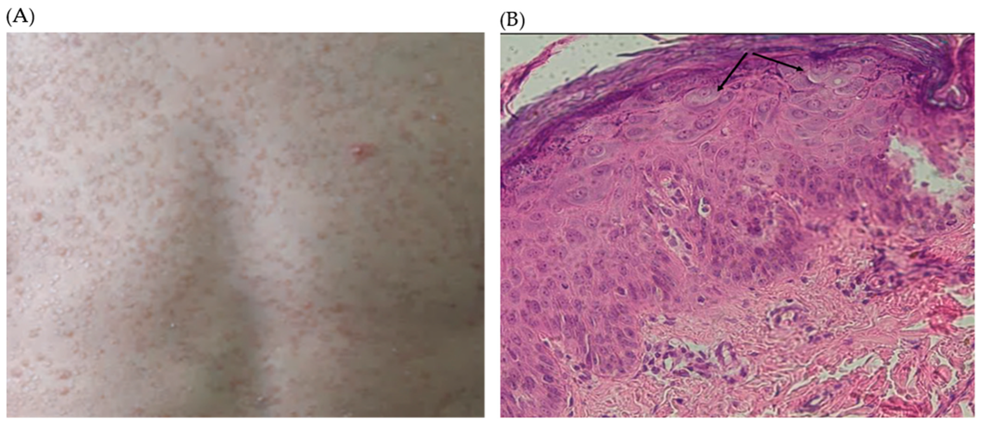 Viruses 16 01415 g002