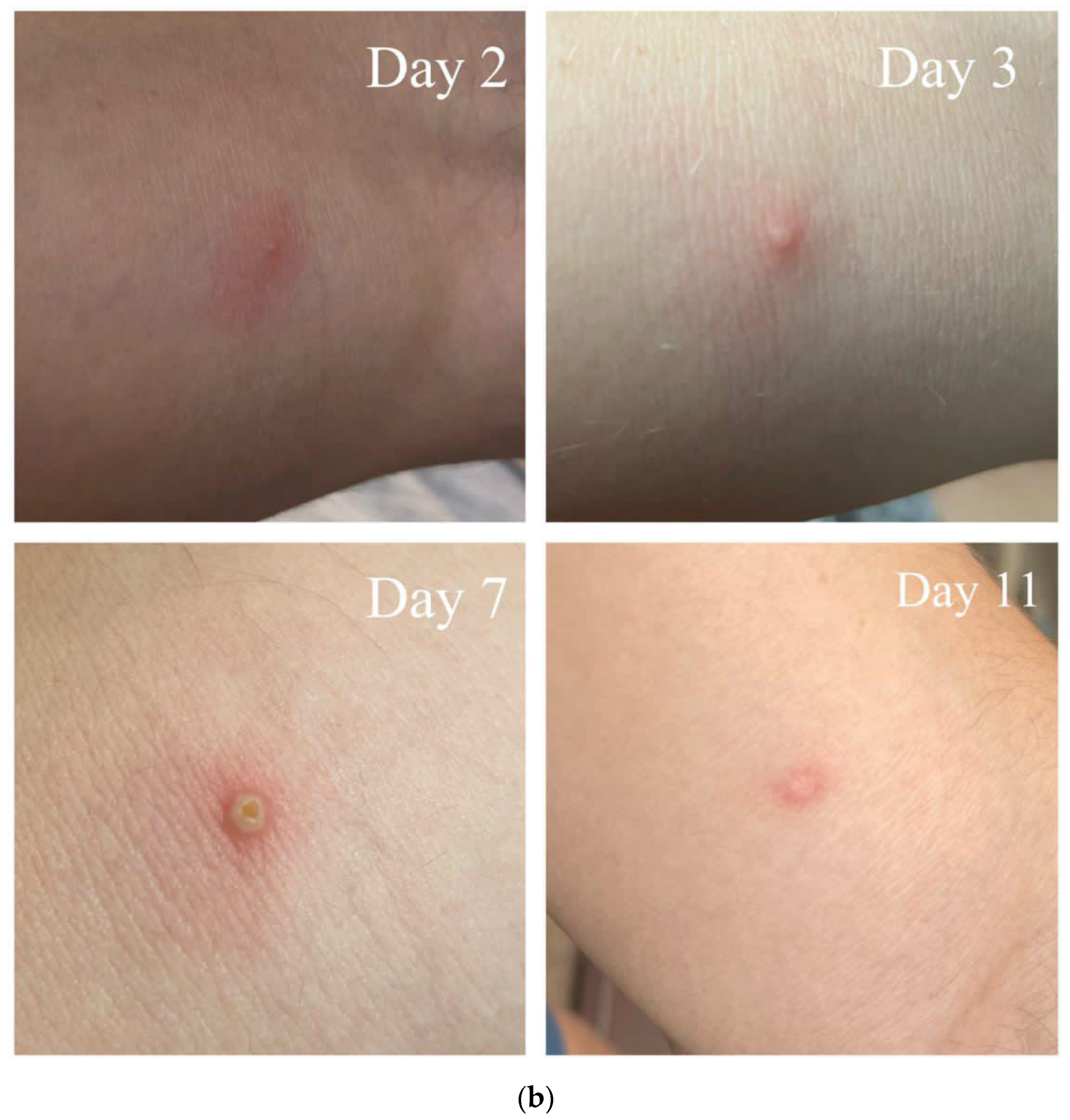 Viruses 16 01620 g003b