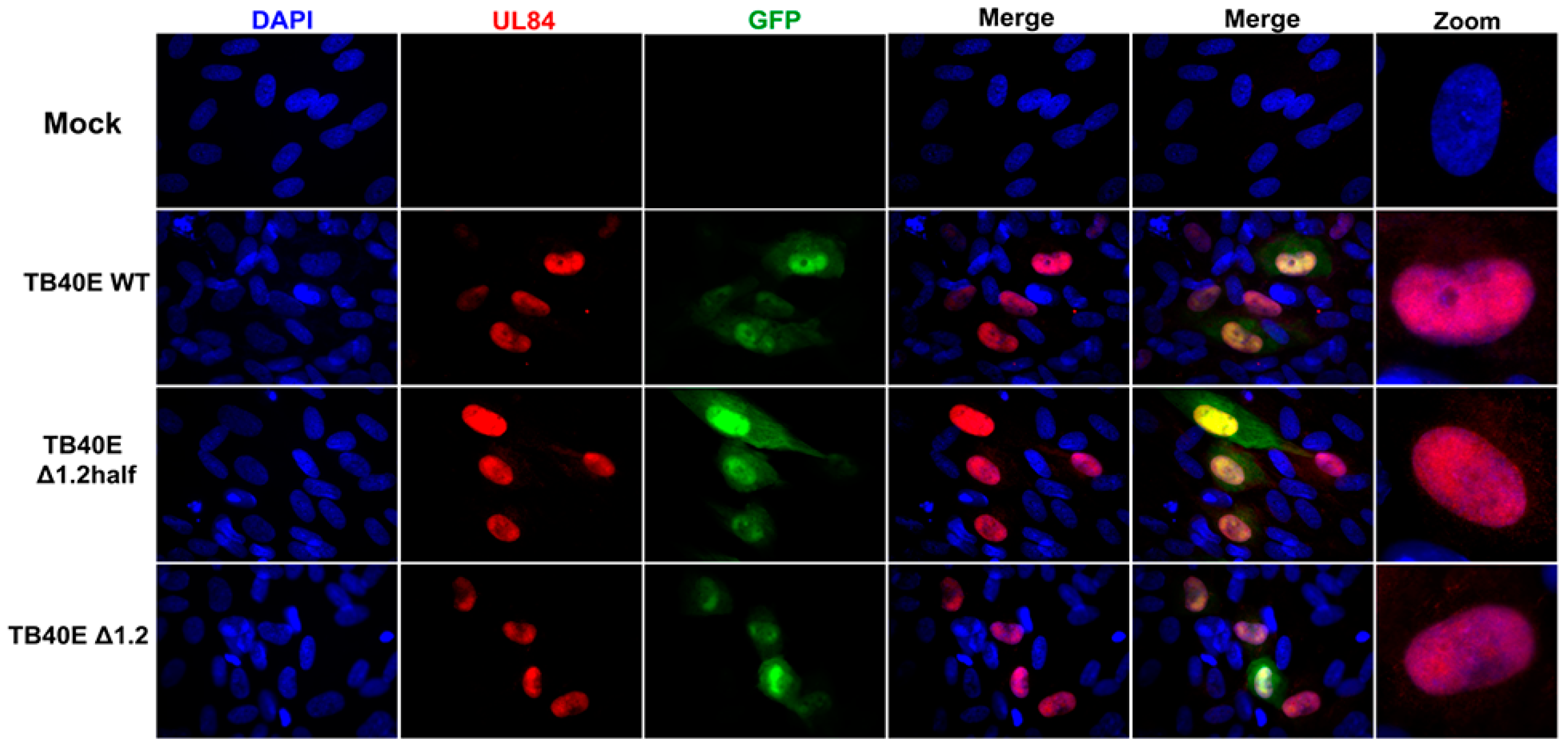 Viruses 17 00149 g003b