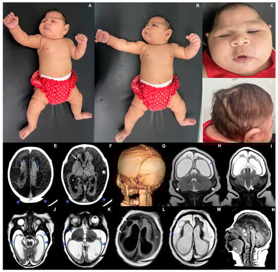 Viruses 17 00397 g001