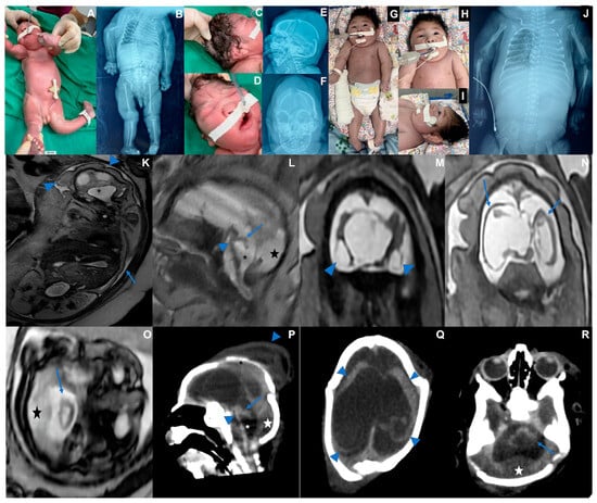 Viruses 17 00397 g002