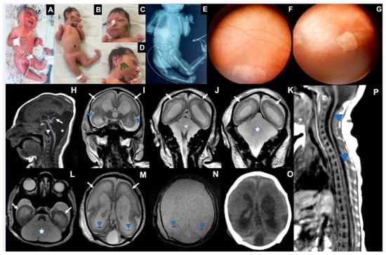 Viruses 17 00397 g003