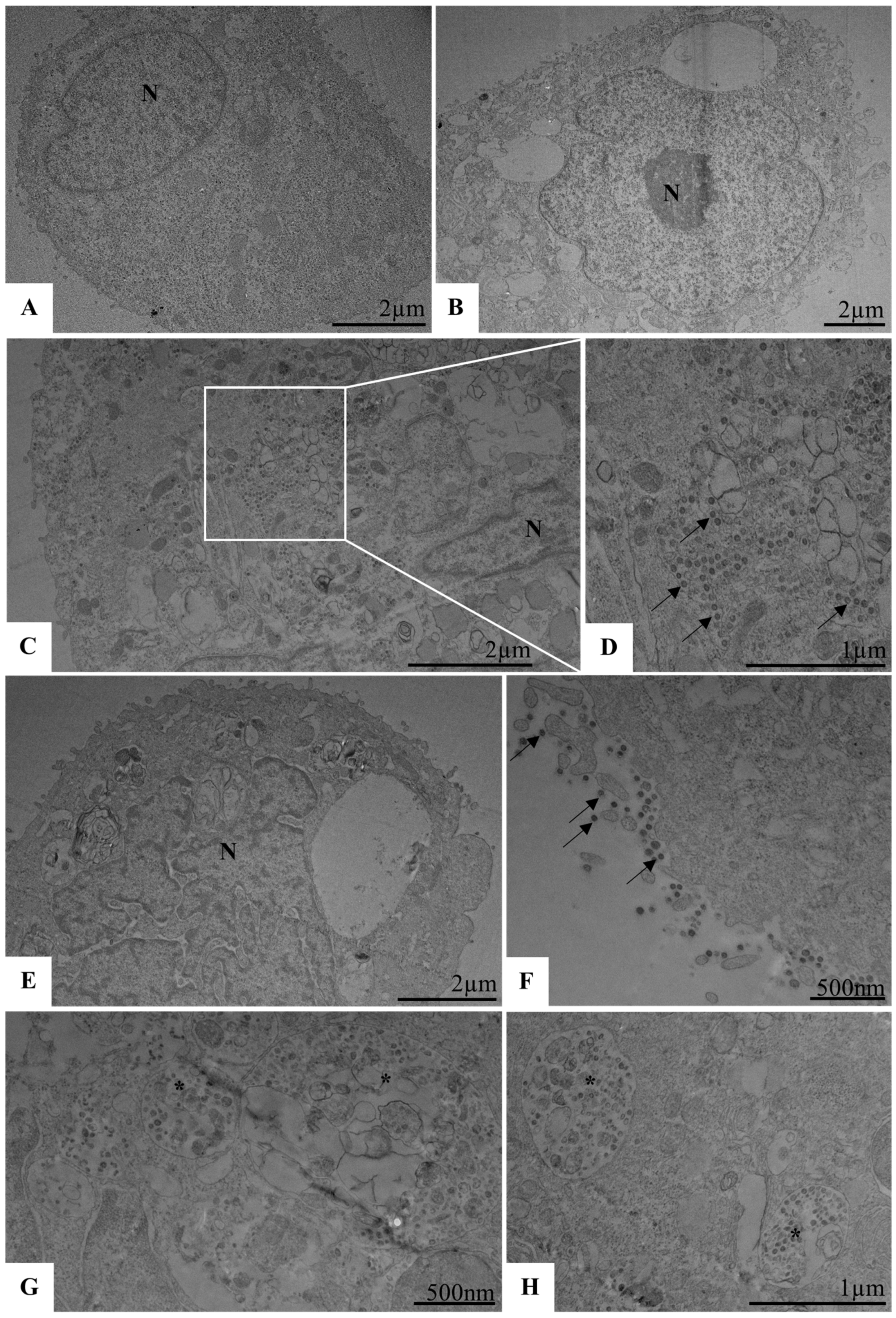 Viruses 17 00518 g004