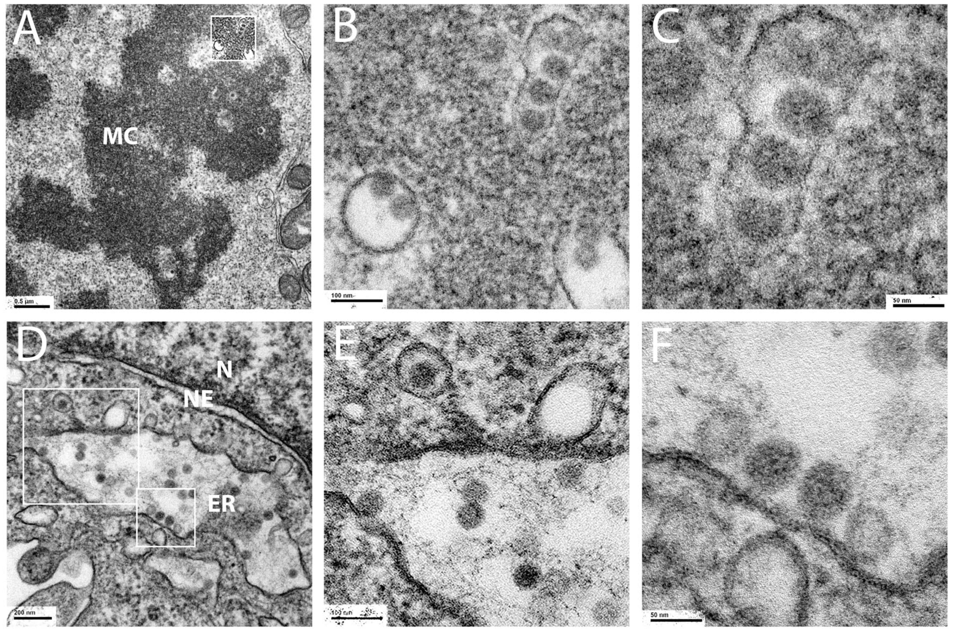 Viruses 17 00616 g001