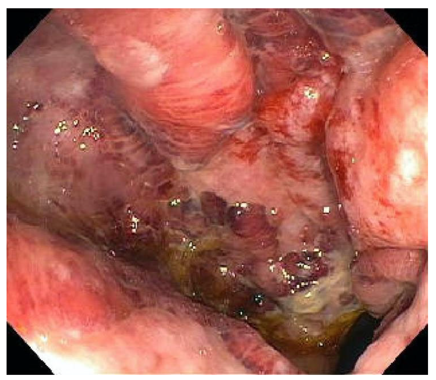 Viruses 17 00752 g001