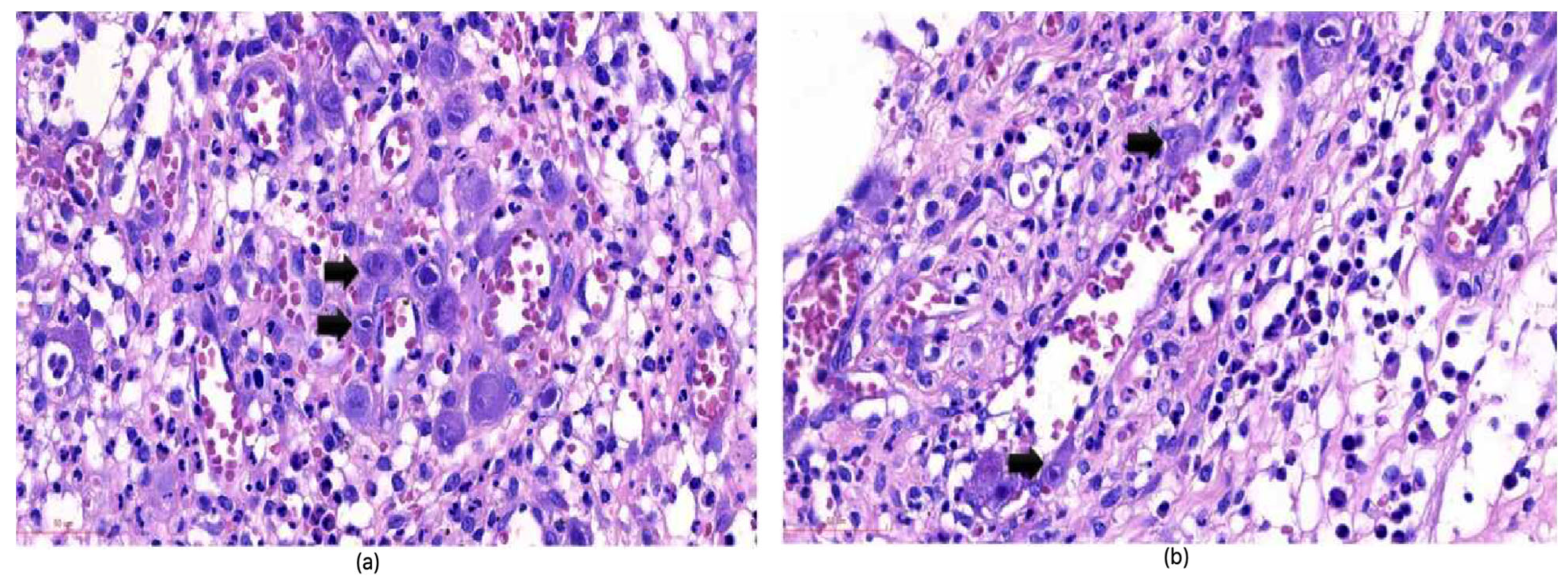 Viruses 17 00752 g002