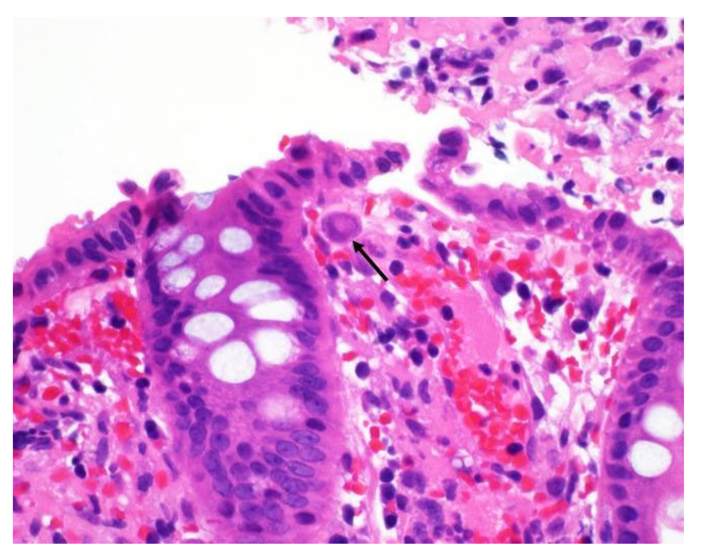 Viruses 17 00752 g003