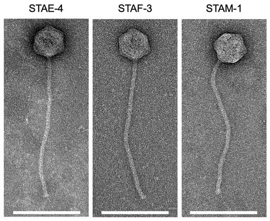Transmission Electron Microscopy Images of Bacteriophages STAE-4, STAF-3, and STAM-1, at 200 kV and 50,000× magnification (white scale bar: 200 nm).