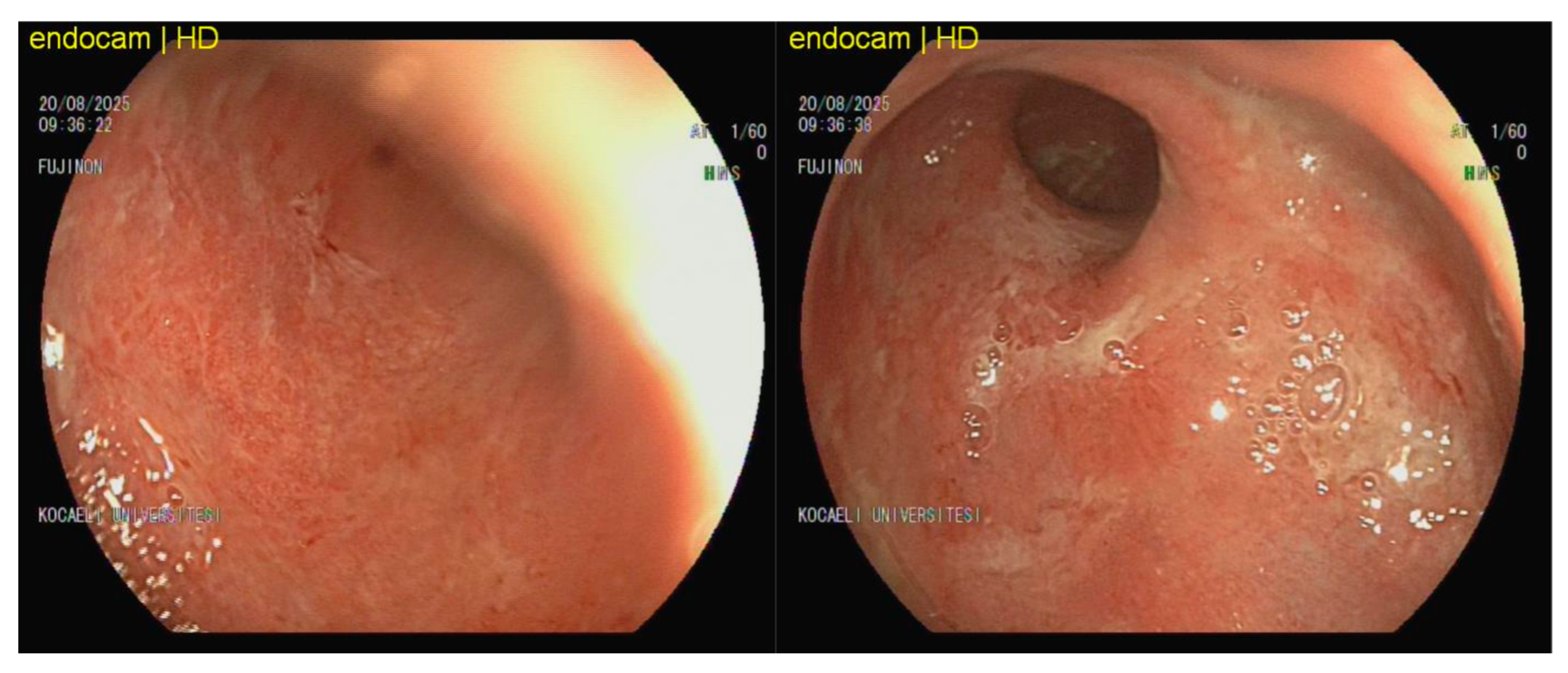 Viruses 18 00188 g002 Viruses 18 00188 g002