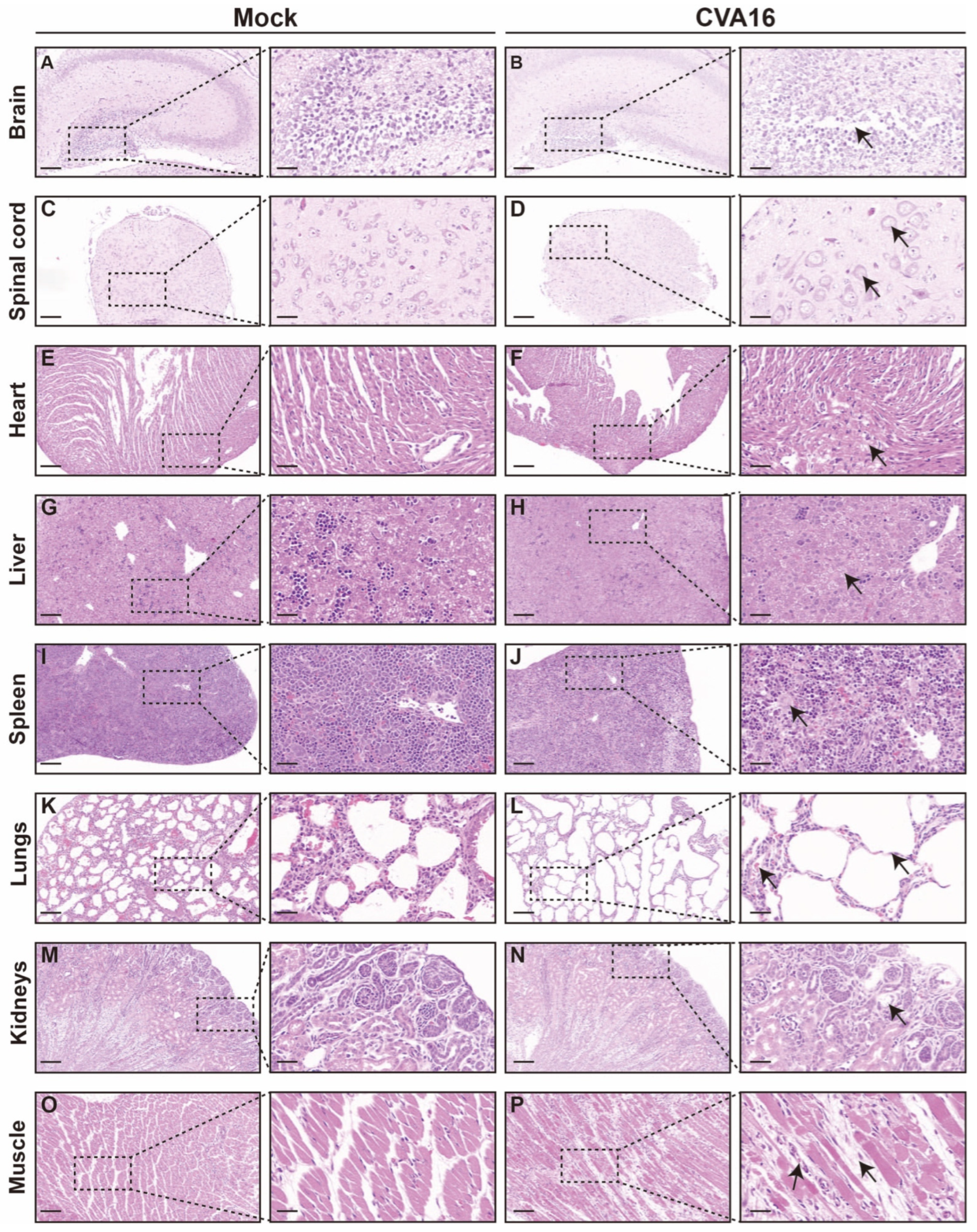 Viruses 18 00192 g005 Viruses 18 00192 g005