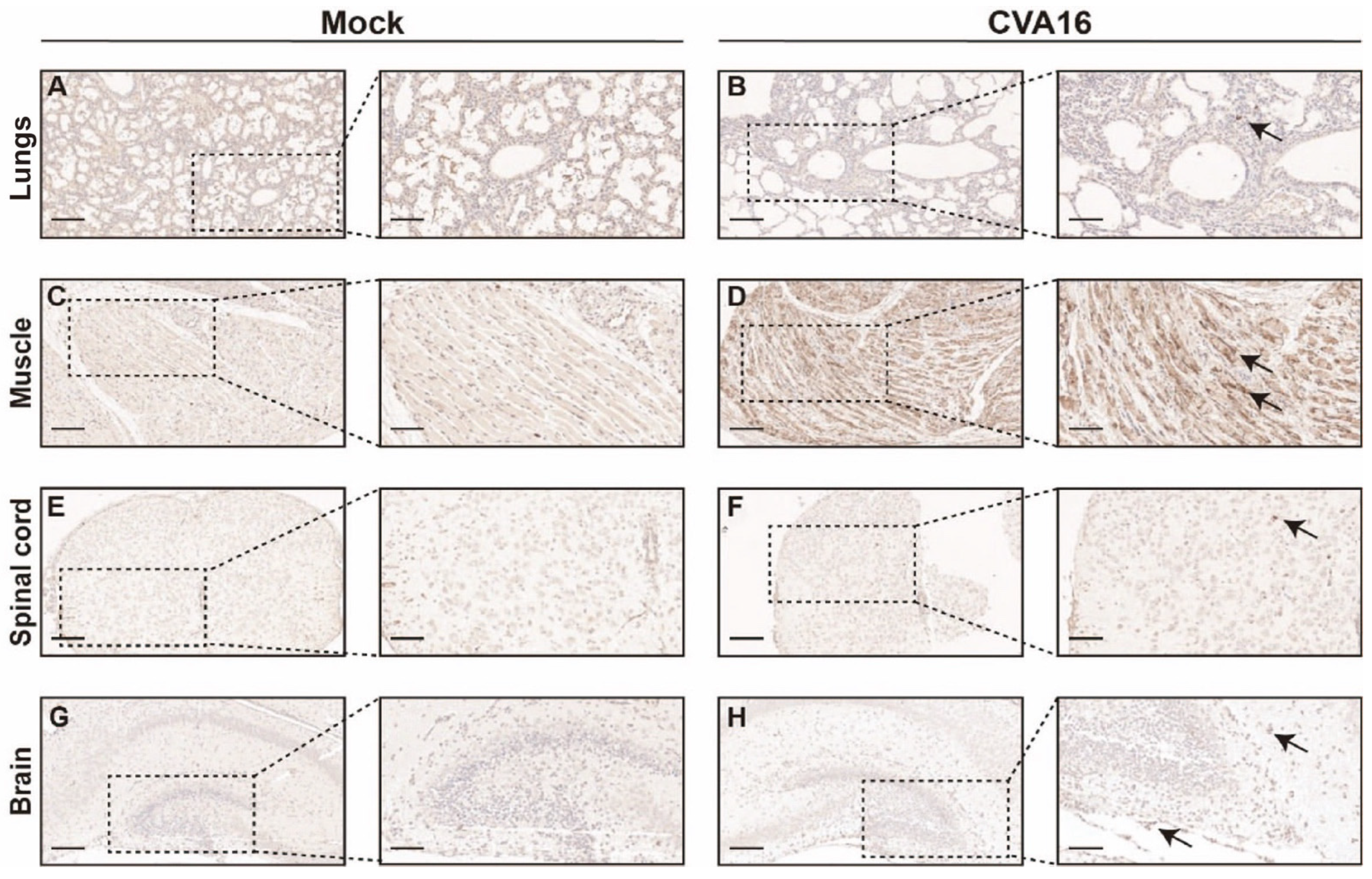 Viruses 18 00192 g006 Viruses 18 00192 g006