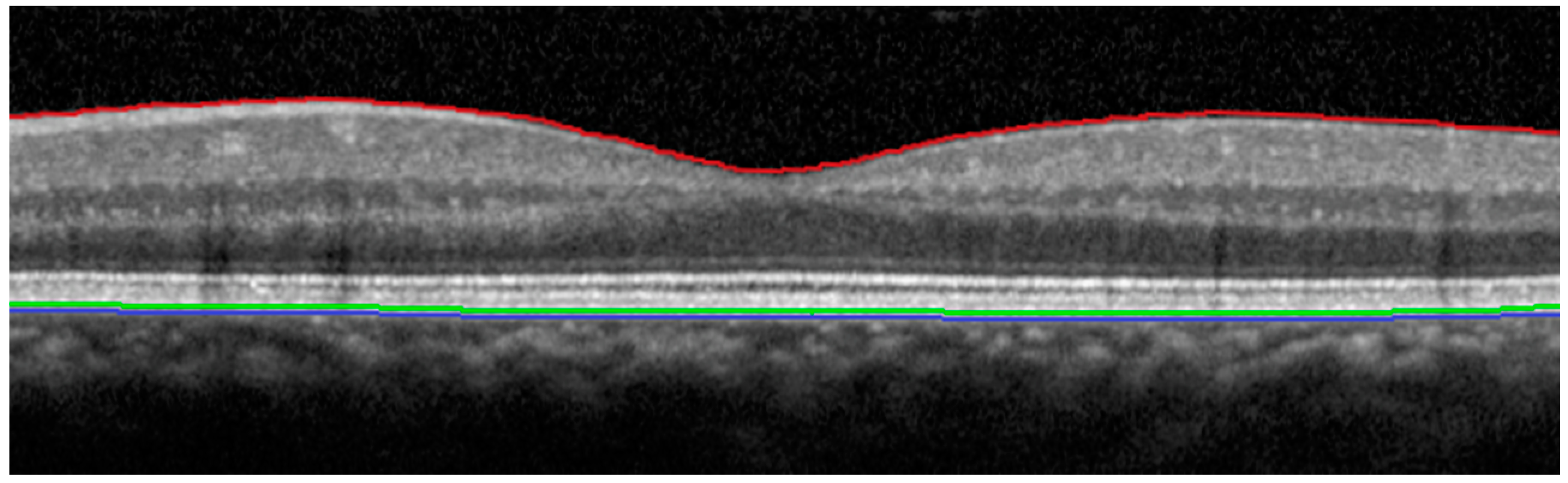 Vision 01 00002 g001