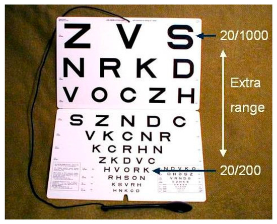 Vision 02 00004 g0a3 550