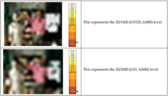 Vision 02 00004 g0a4d 550