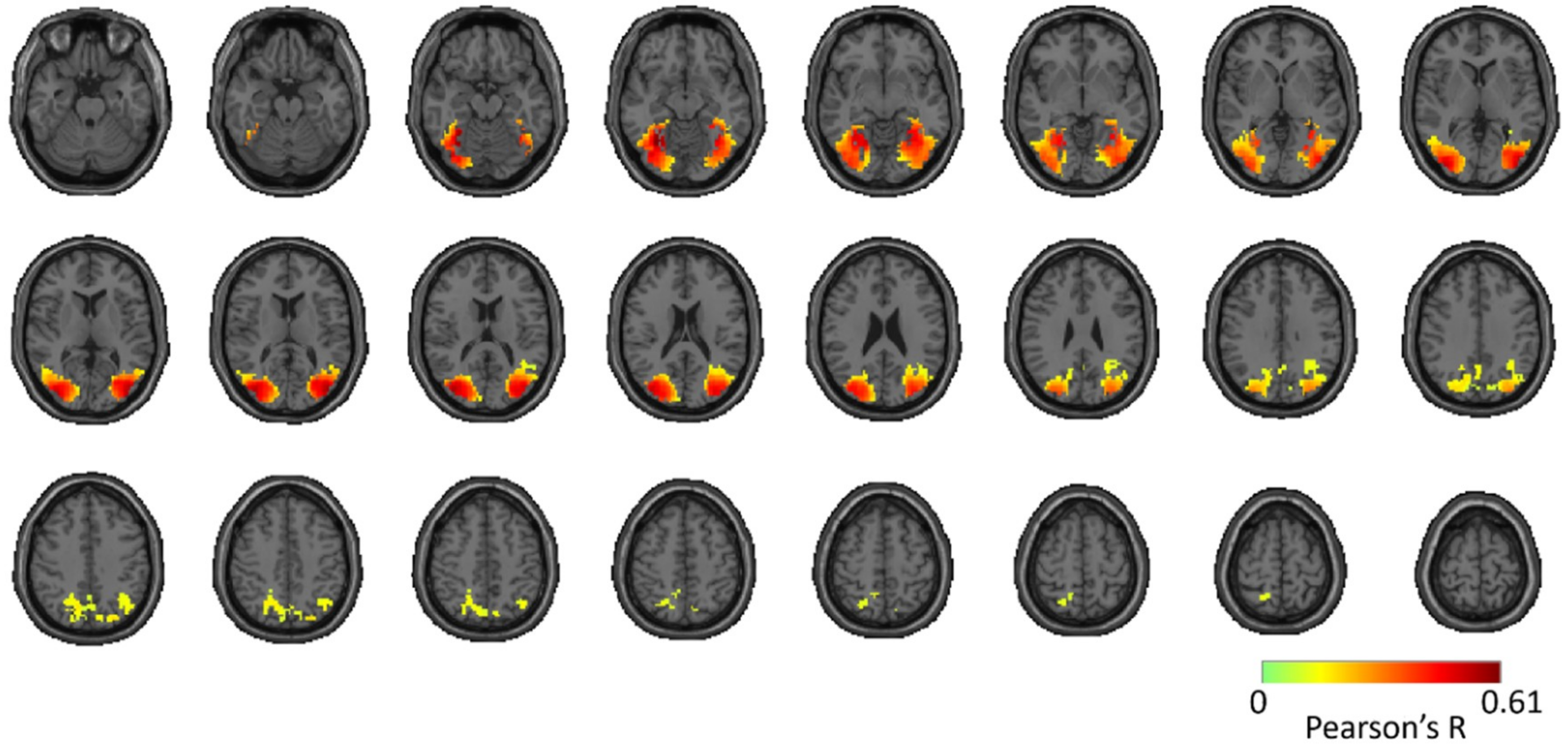 Vision 03 00008 g005