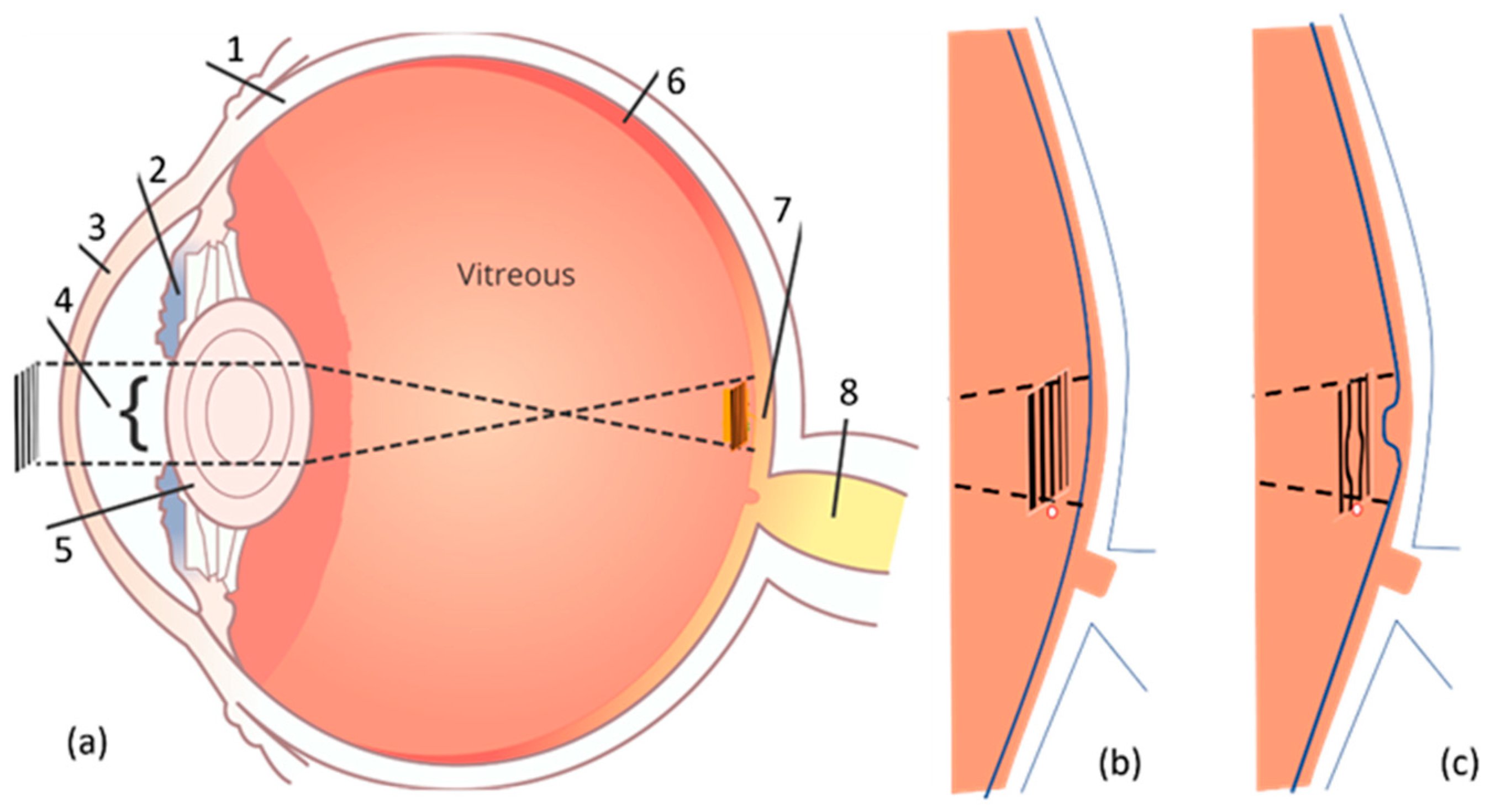 Vision 03 00025 g001 Vision 03 00025 g001