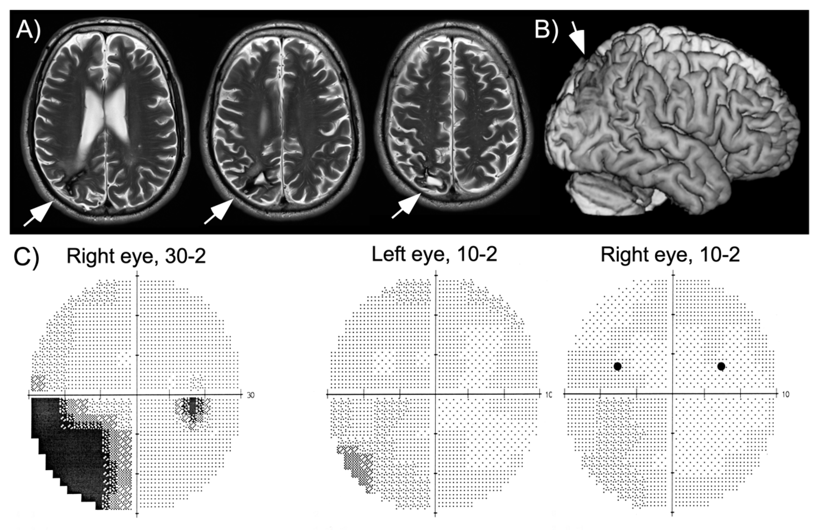Vision 04 00016 g001 Vision 04 00016 g001
