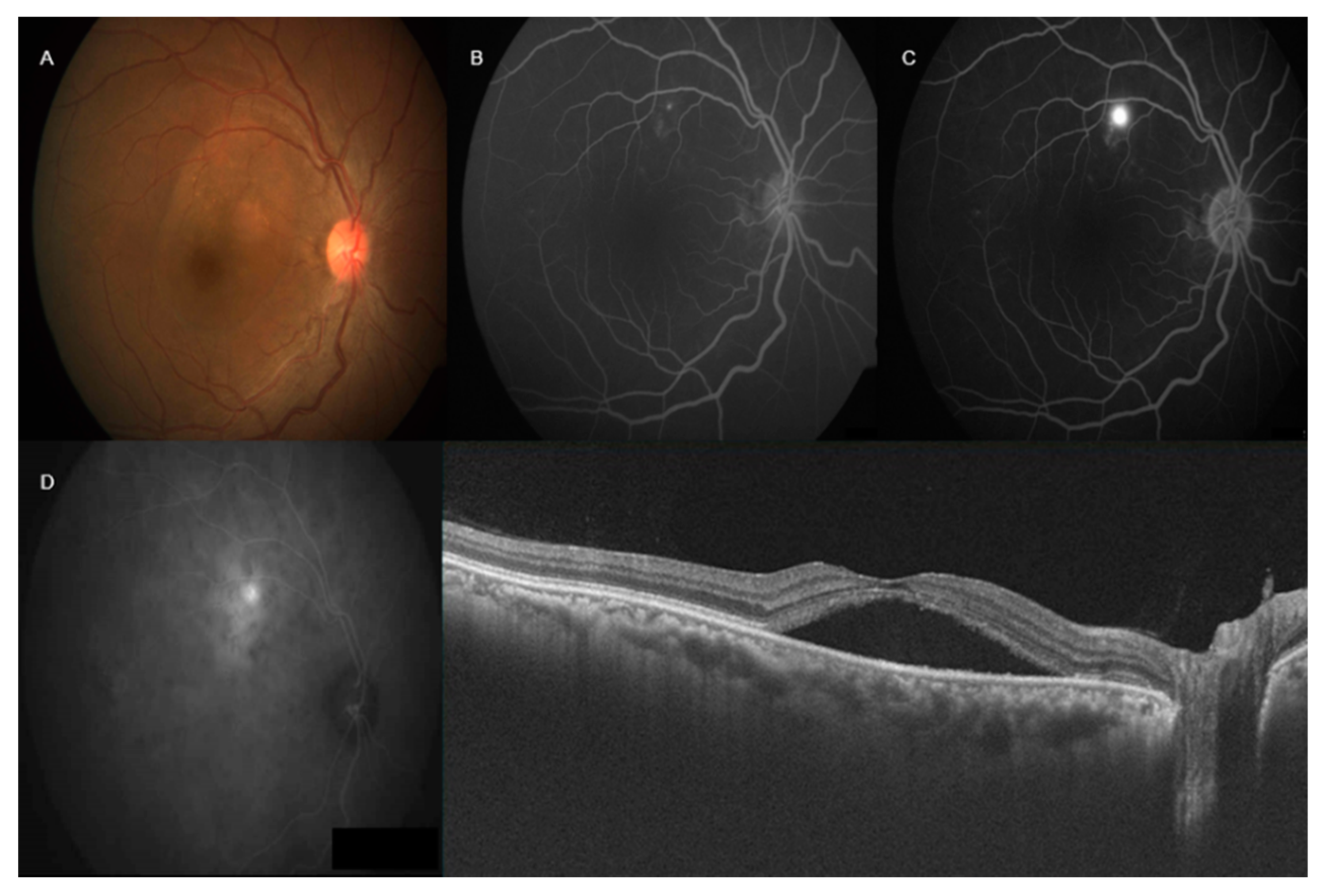 Vision 04 00044 g001 Vision 04 00044 g001