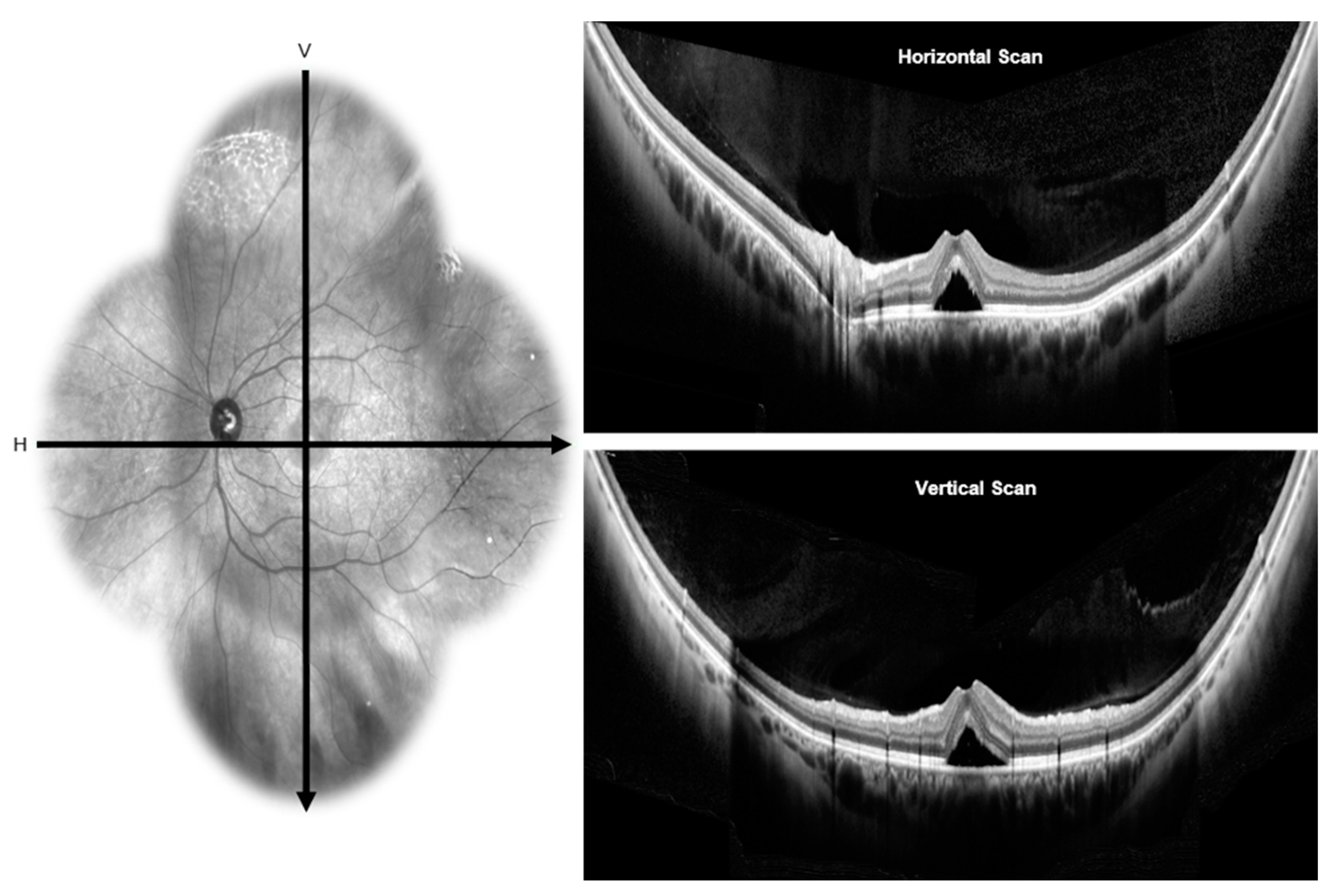 Vision 04 00044 g003 Vision 04 00044 g003