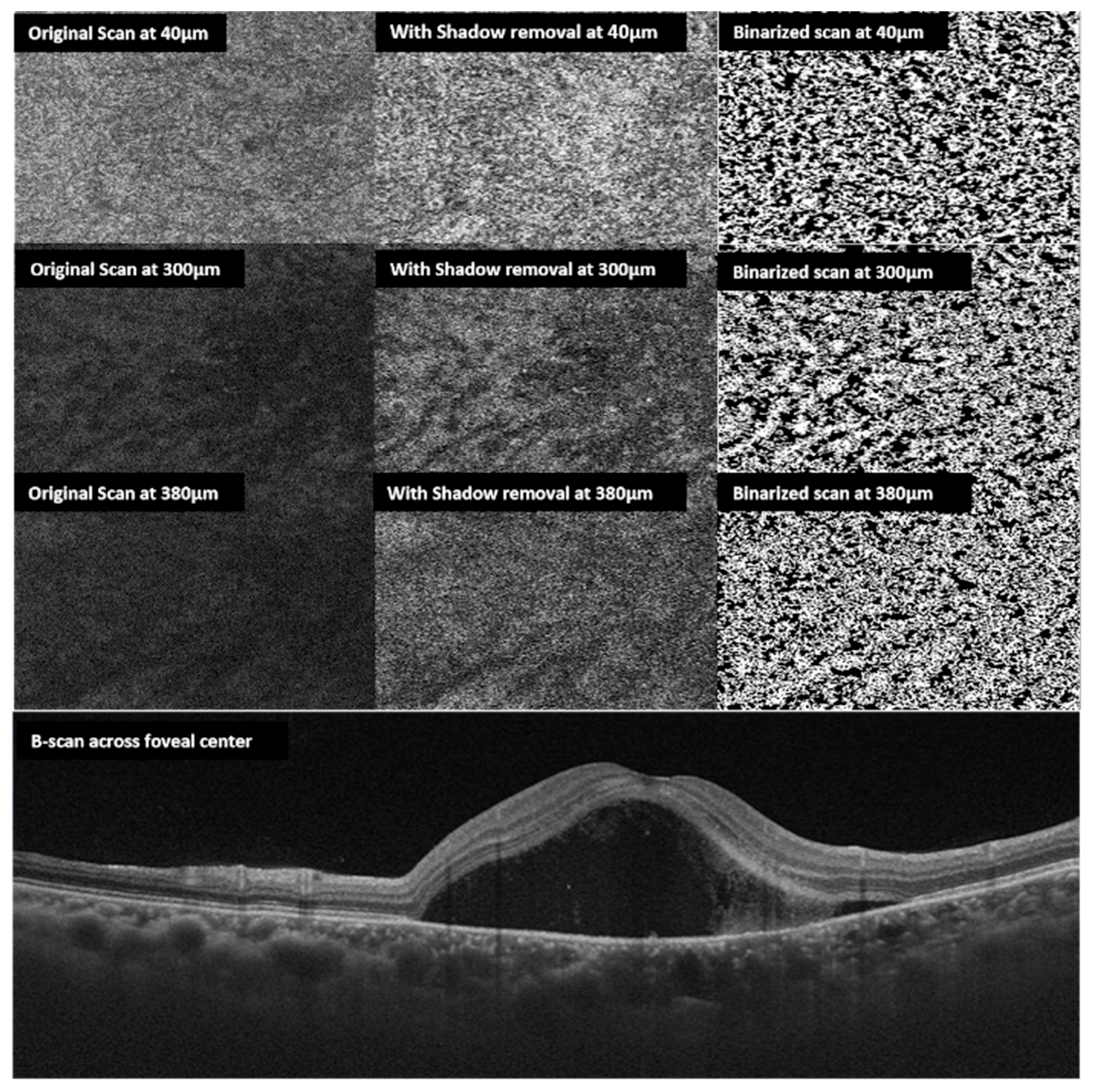 Vision 04 00044 g004 Vision 04 00044 g004