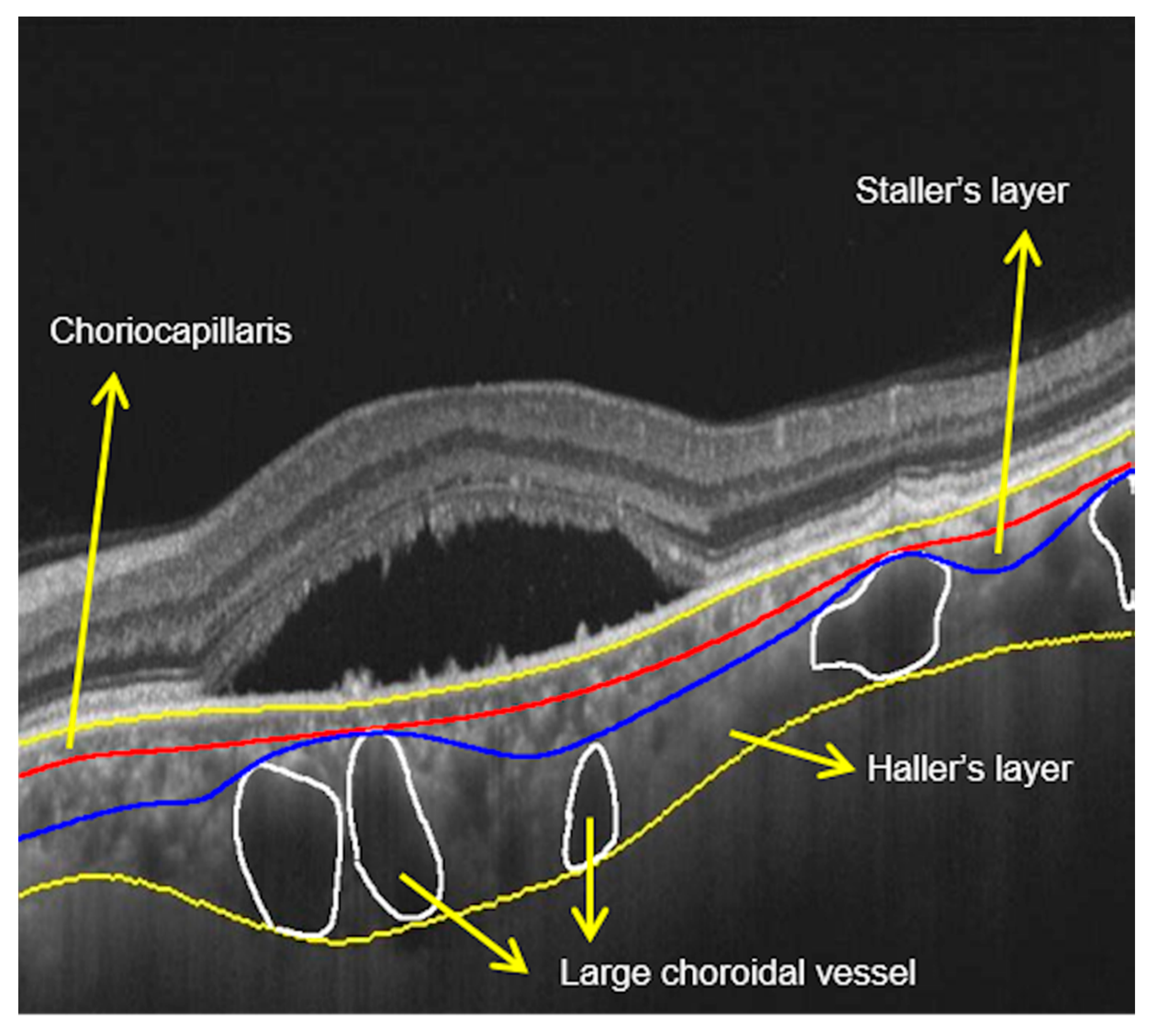 Vision 04 00044 g007 Vision 04 00044 g007