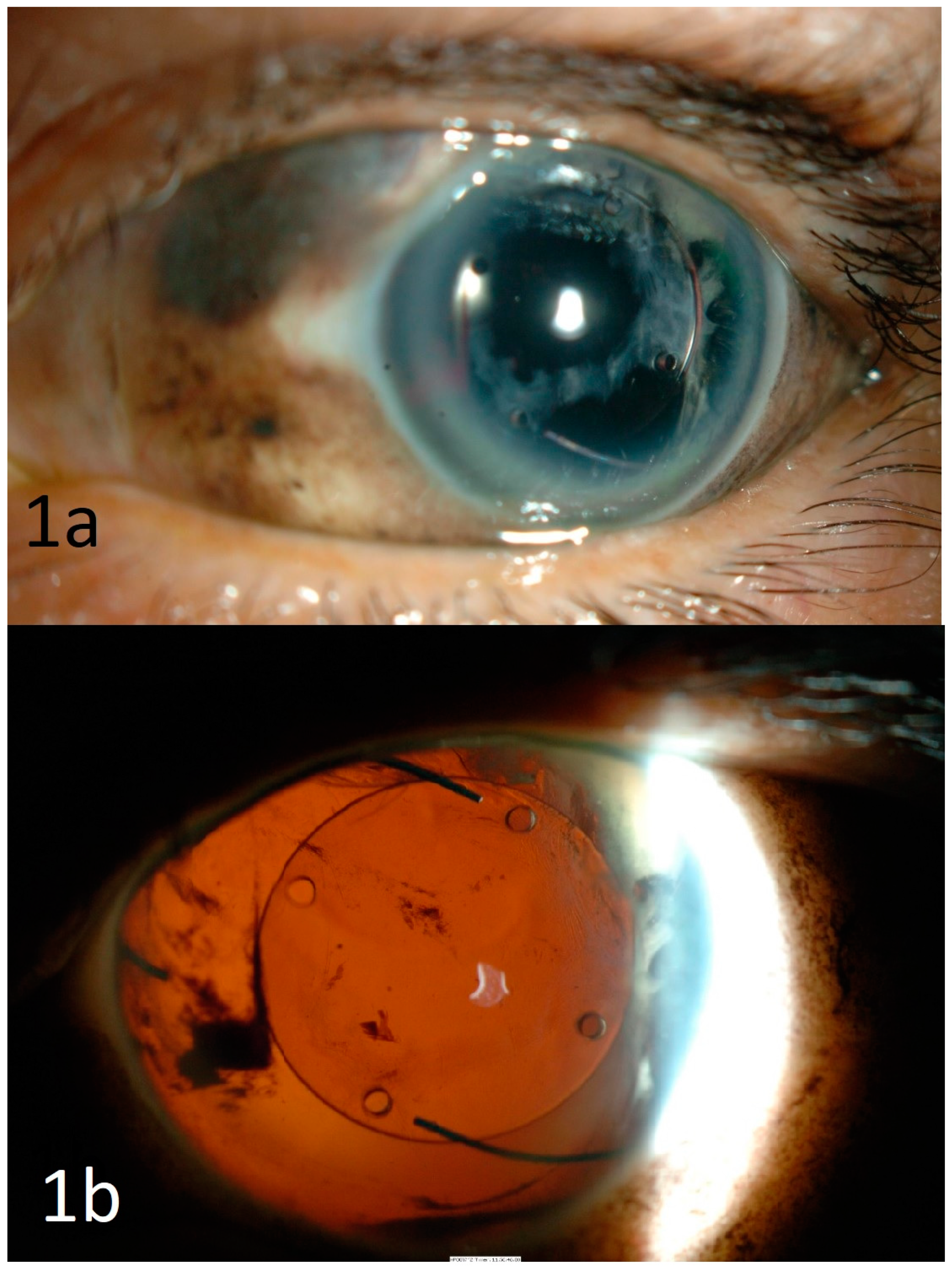 Vision 05 00011 g001 Vision 05 00011 g001