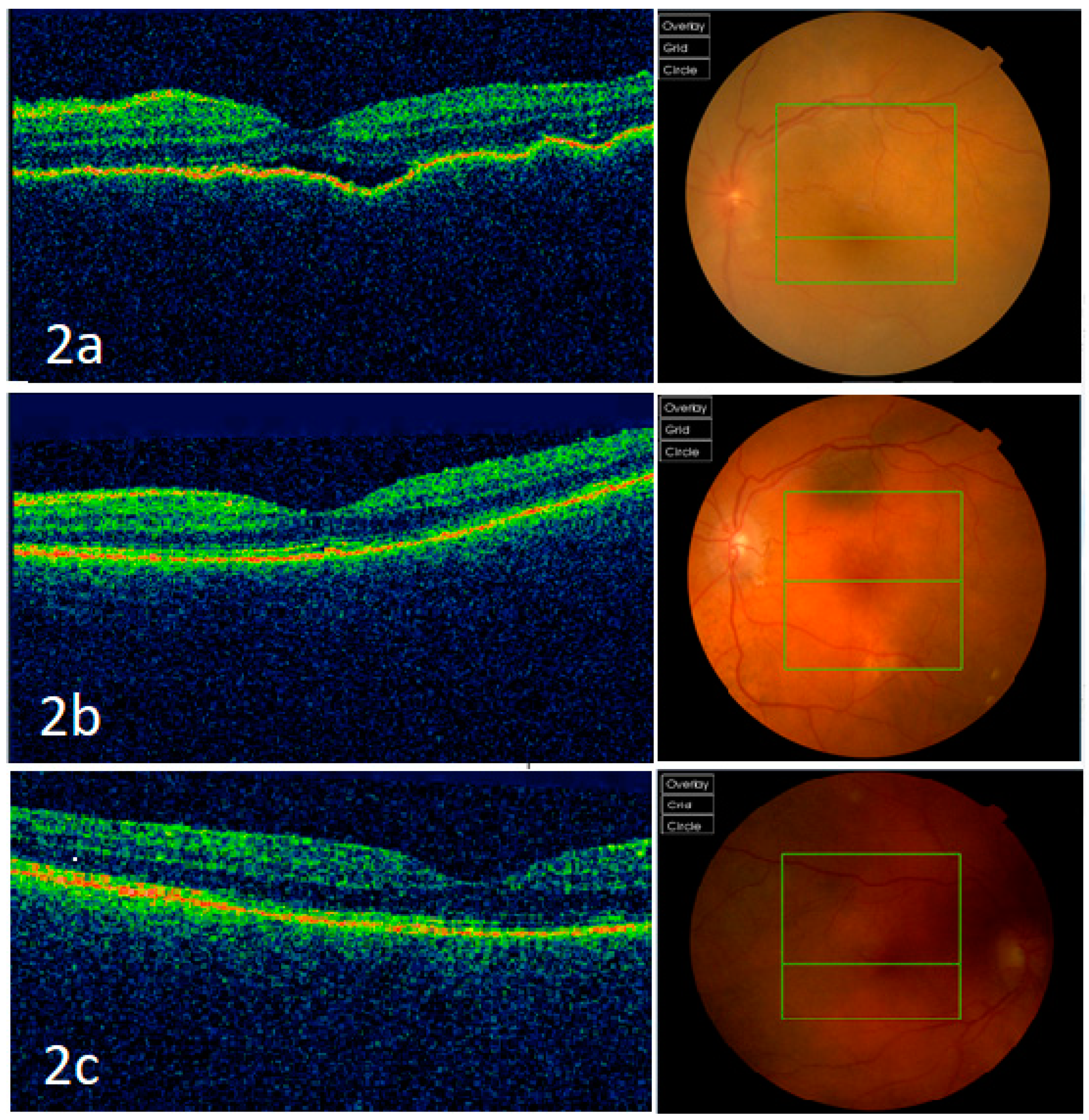 Vision 05 00011 g002 Vision 05 00011 g002