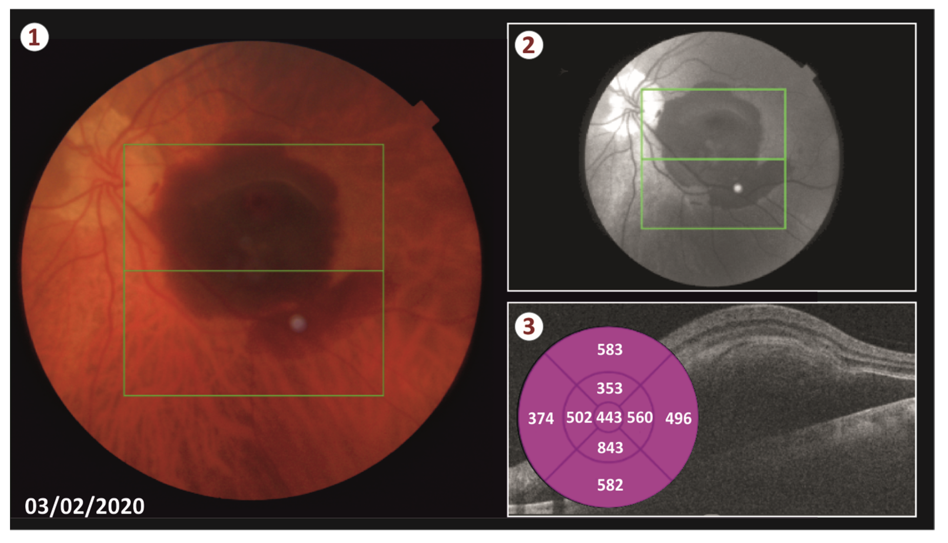 Vision 05 00023 g001 Vision 05 00023 g001