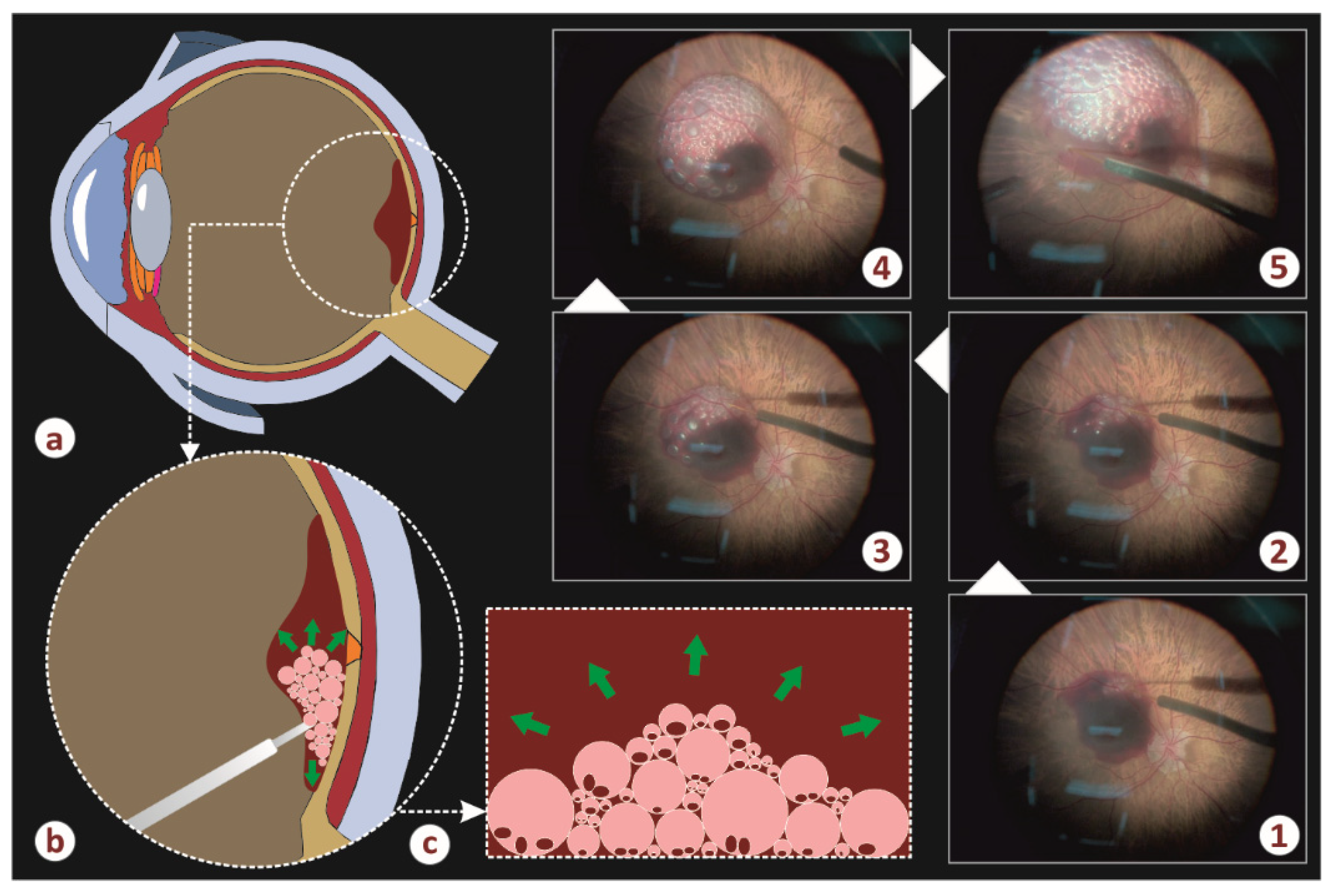 Vision 05 00023 g002 Vision 05 00023 g002