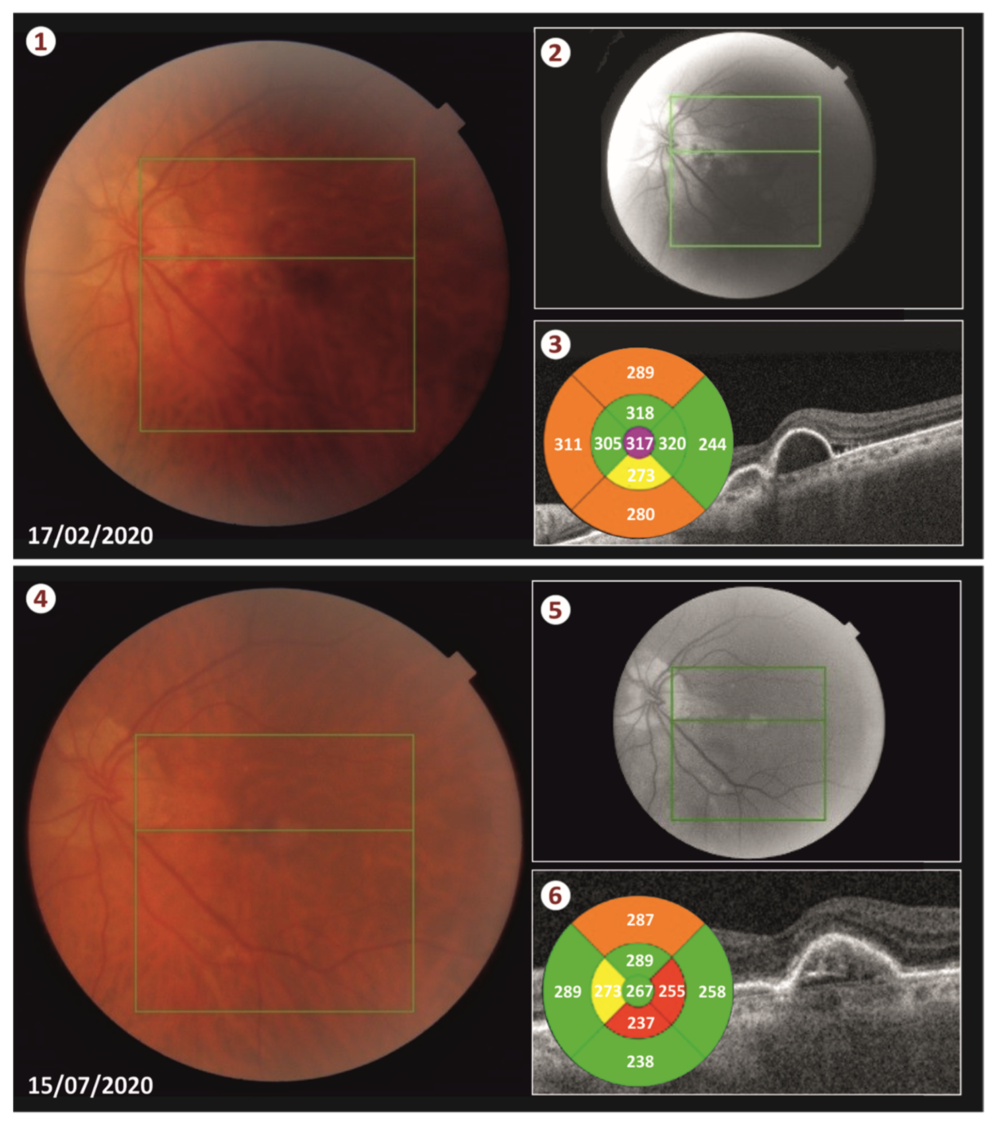 Vision 05 00023 g003 Vision 05 00023 g003
