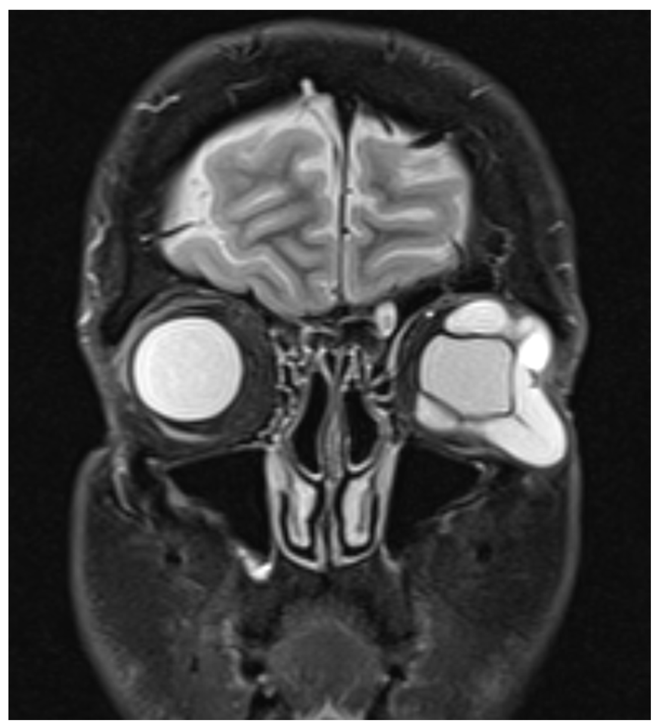 Vision 05 00055 g001