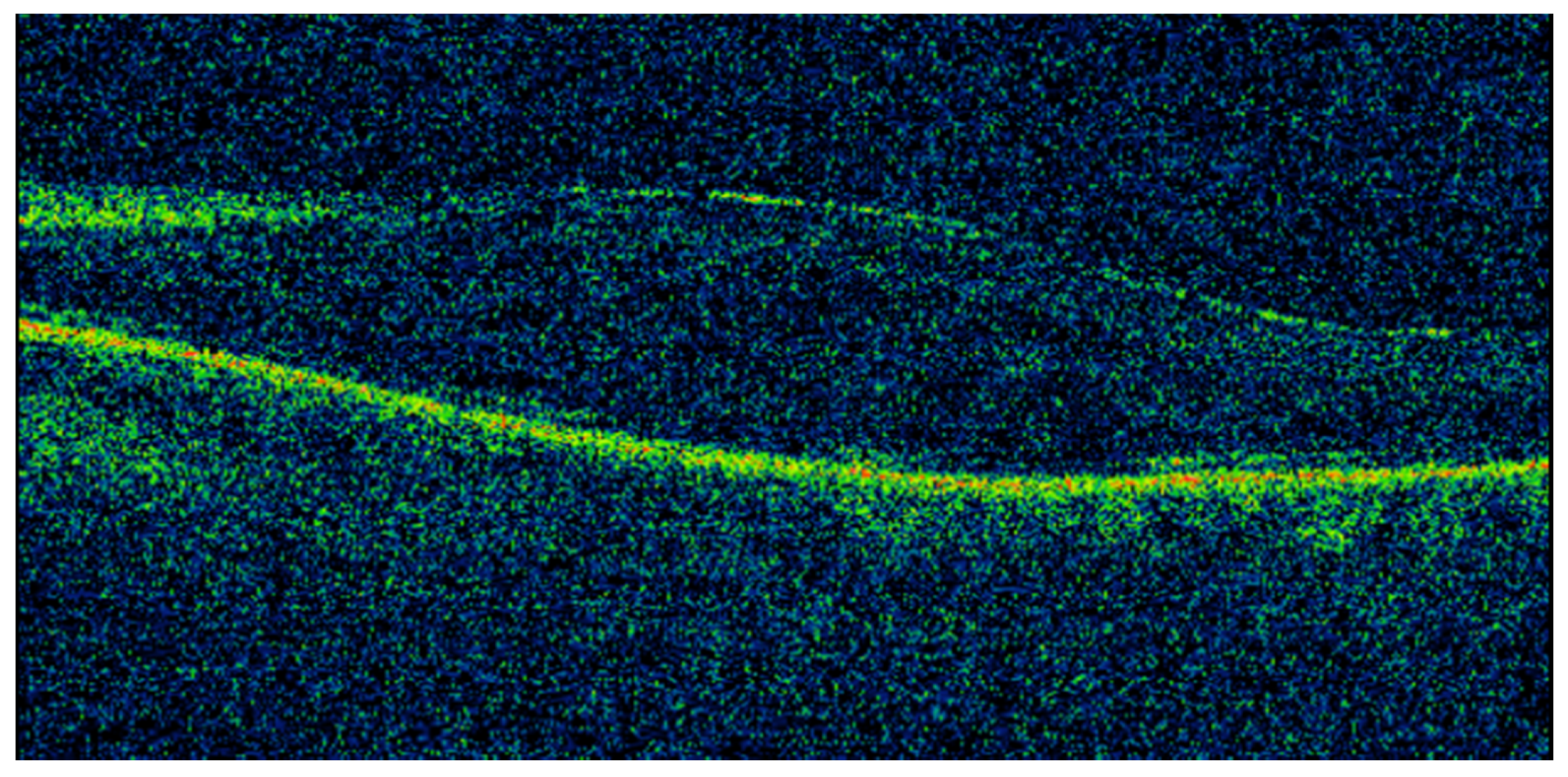 Vision 05 00055 g003