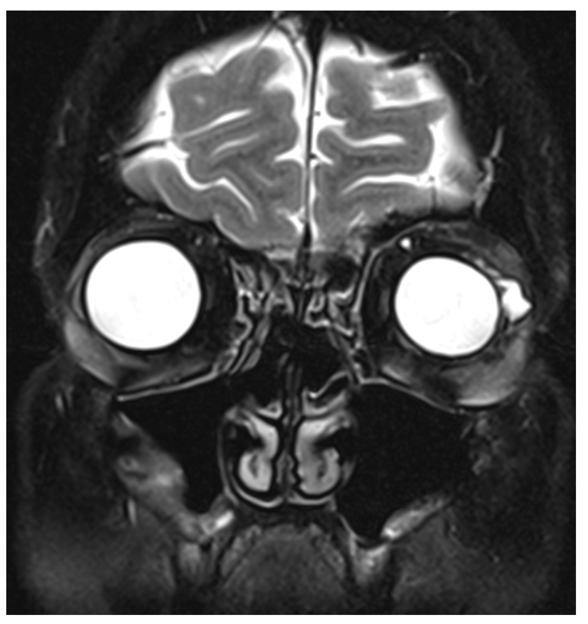 Vision 05 00055 g004