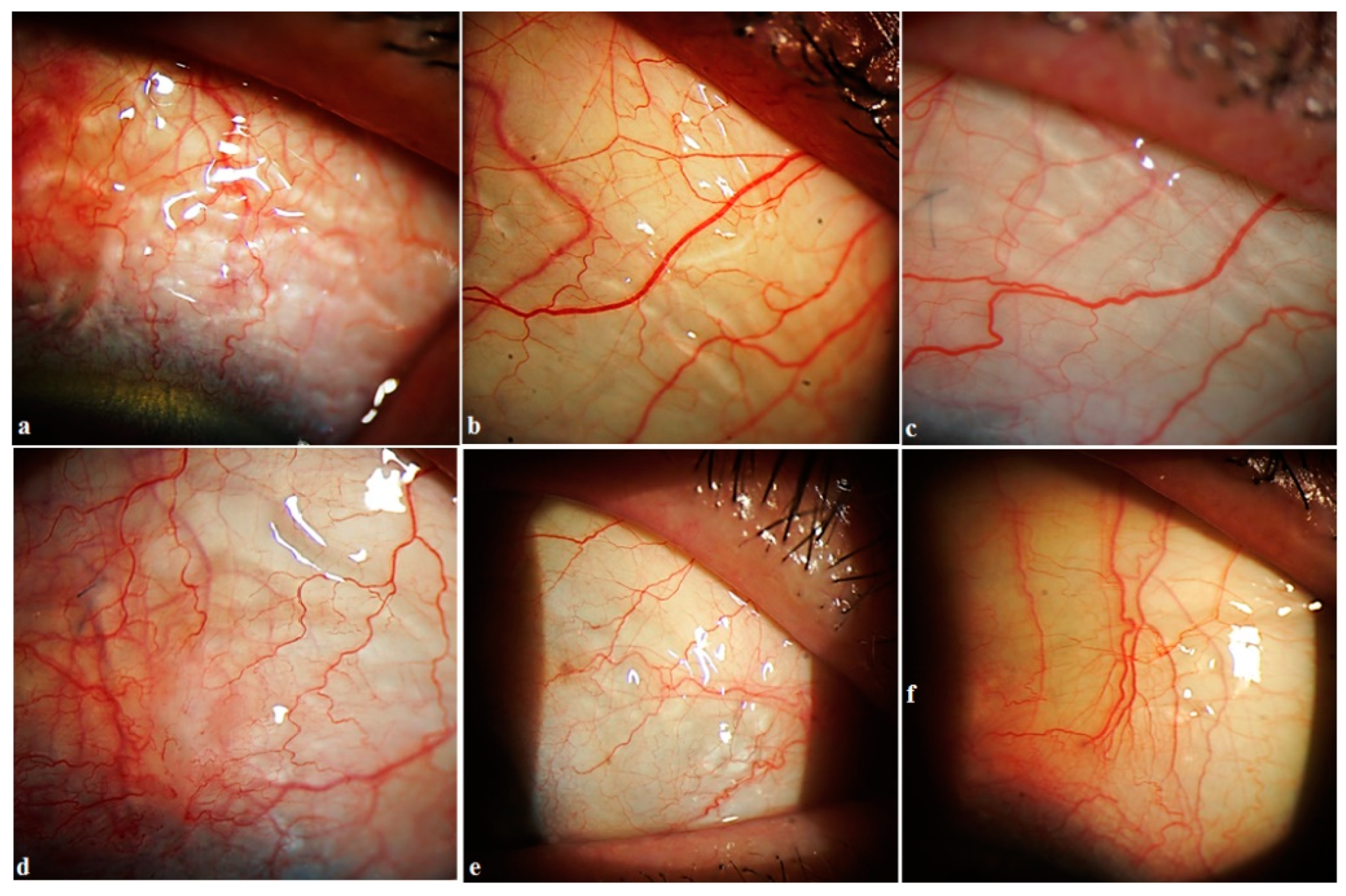 Vision 06 00004 g007