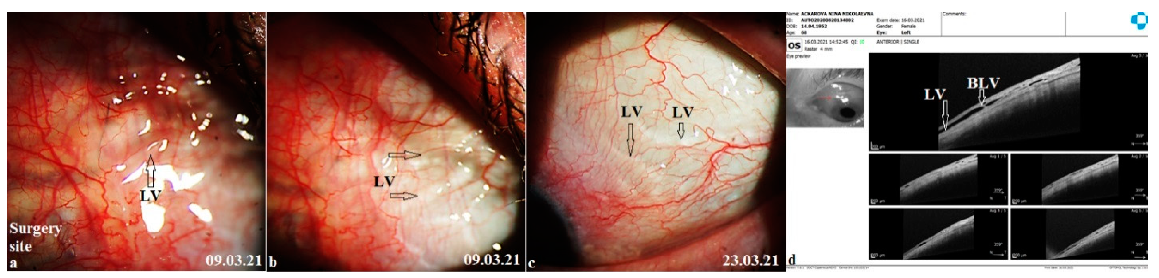 Vision 06 00004 g008